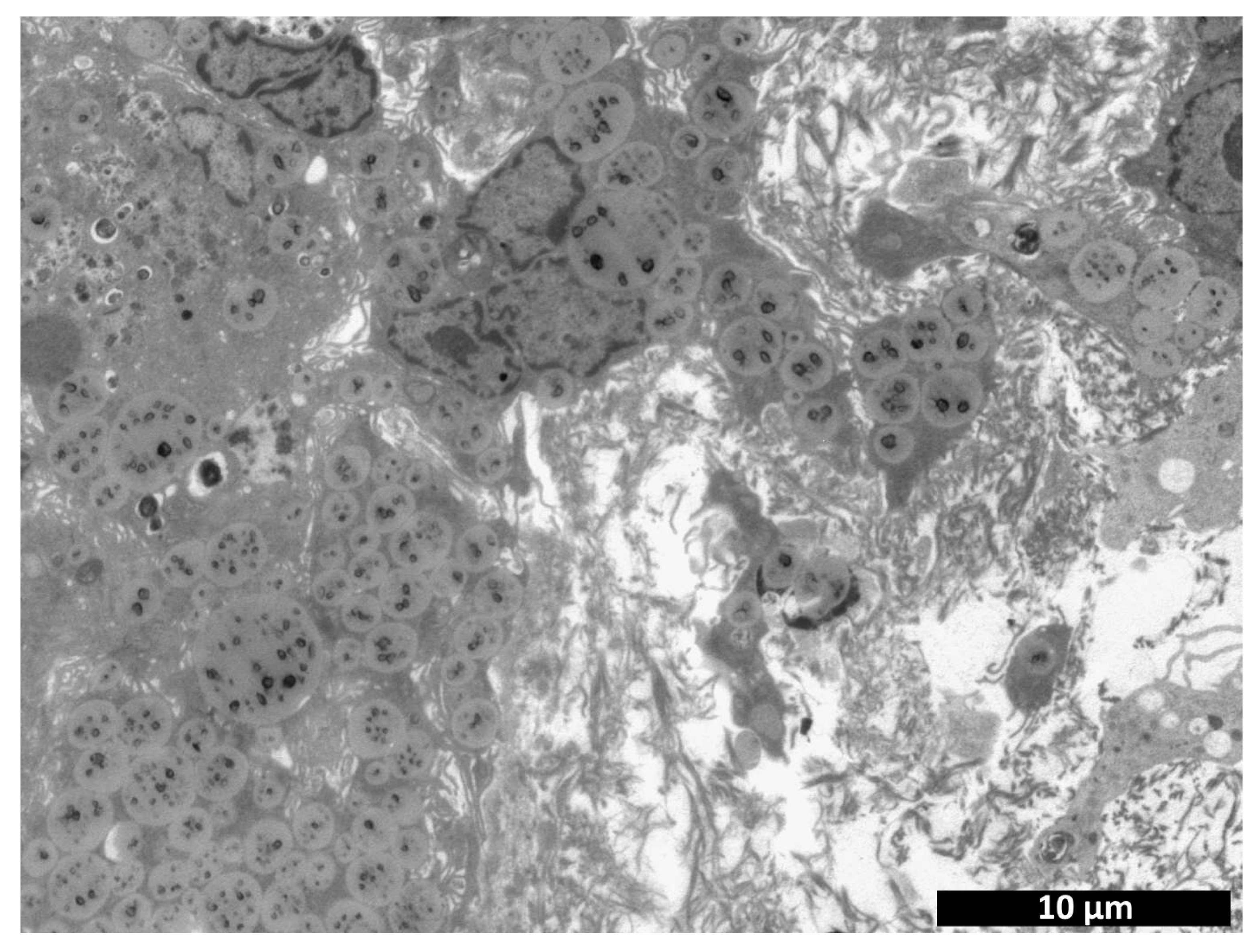 Polymers 15 01337 g013 Polymers 15 01337 g013