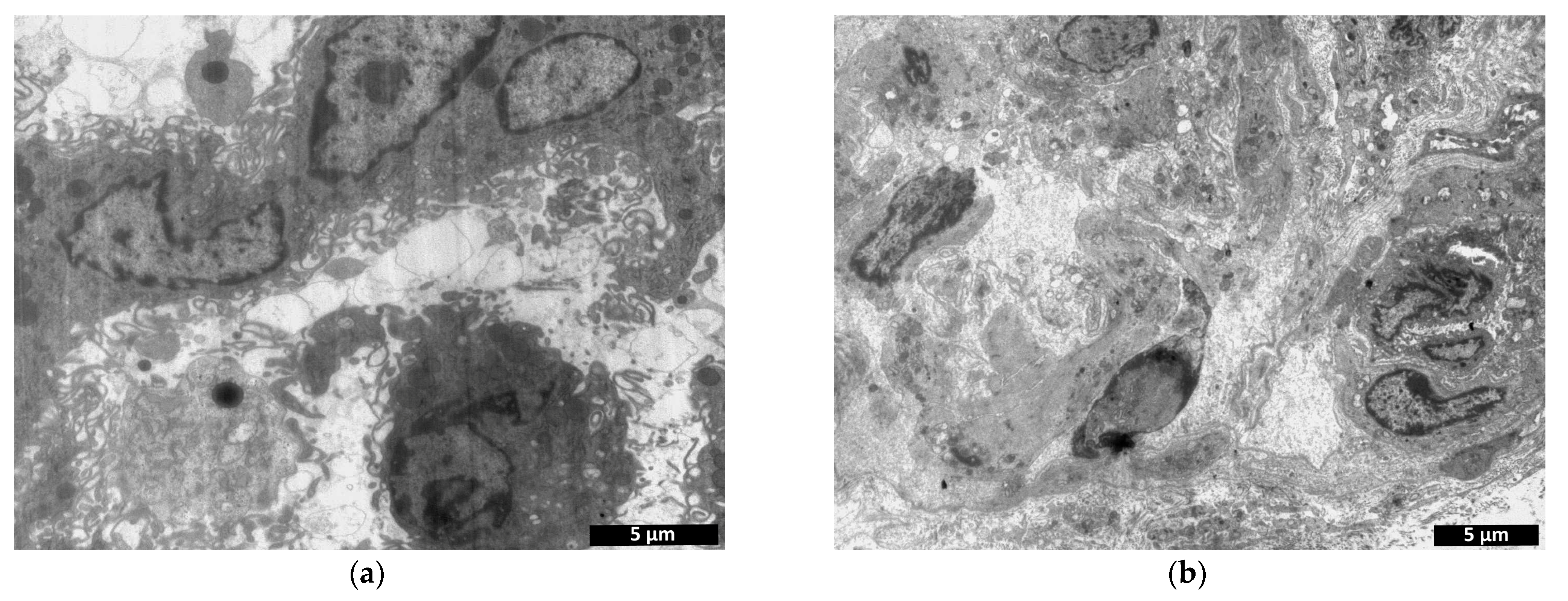 Polymers 15 01337 g014 Polymers 15 01337 g014