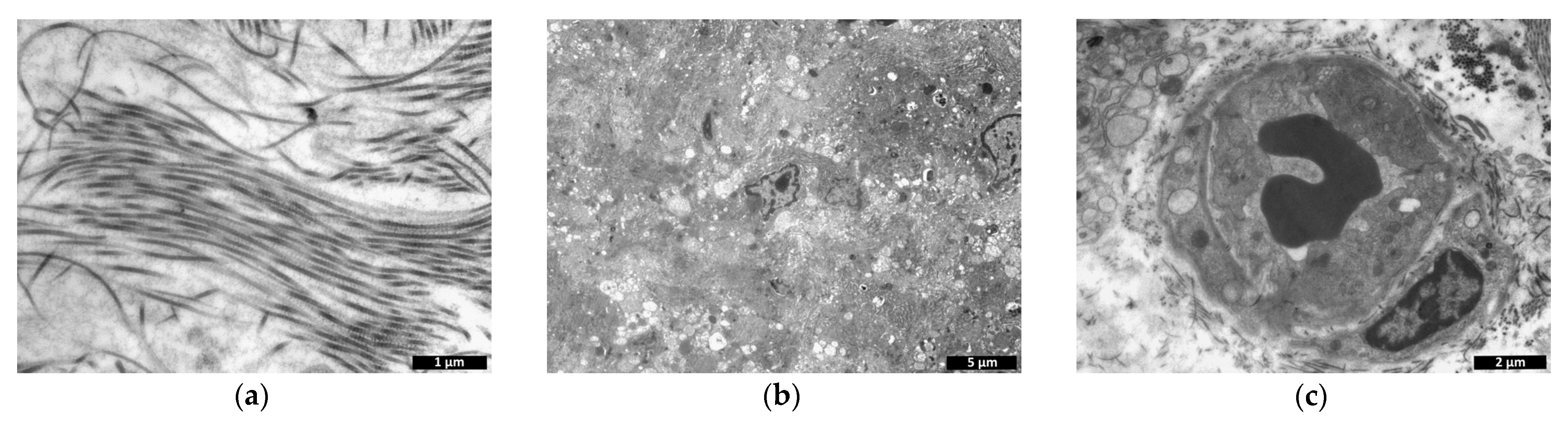 Polymers 15 01337 g015 Polymers 15 01337 g015