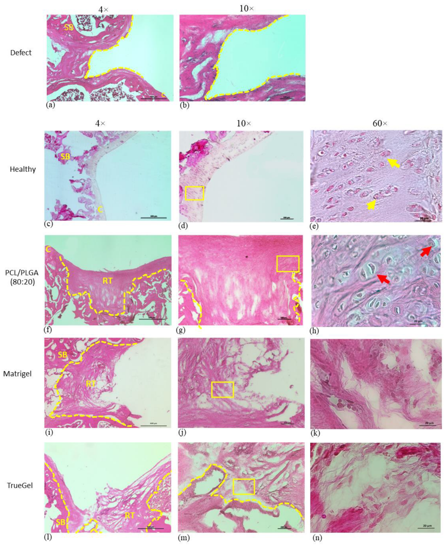 Polymers 15 02324 g013 Polymers 15 02324 g013