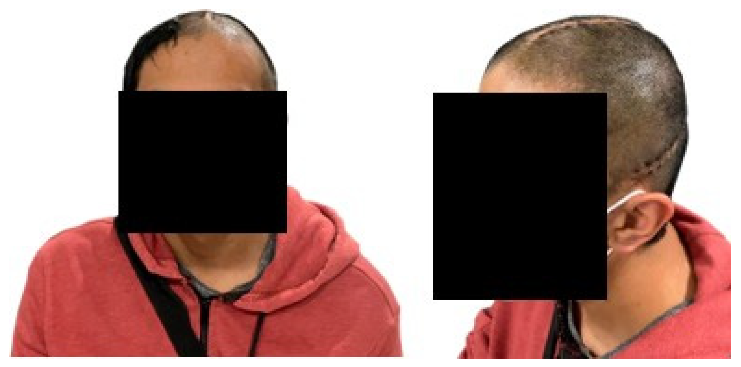 Polymers 15 03620 g015