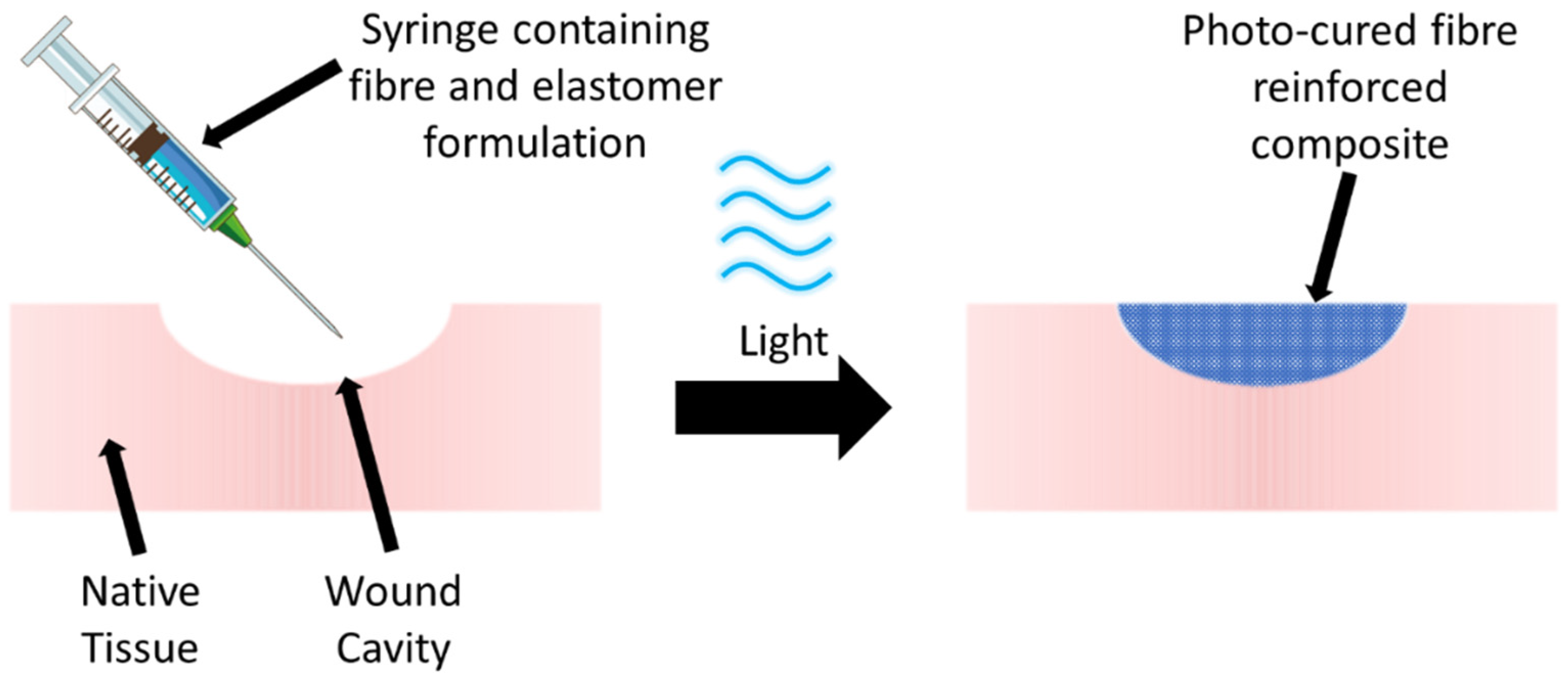 Polymers 16 00869 g001