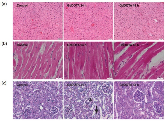 gadolinium and glutathione In Vivo Evaluation of Innovative Gadolinium-Based Contrast Agents Designed  for Bioimaging Applications