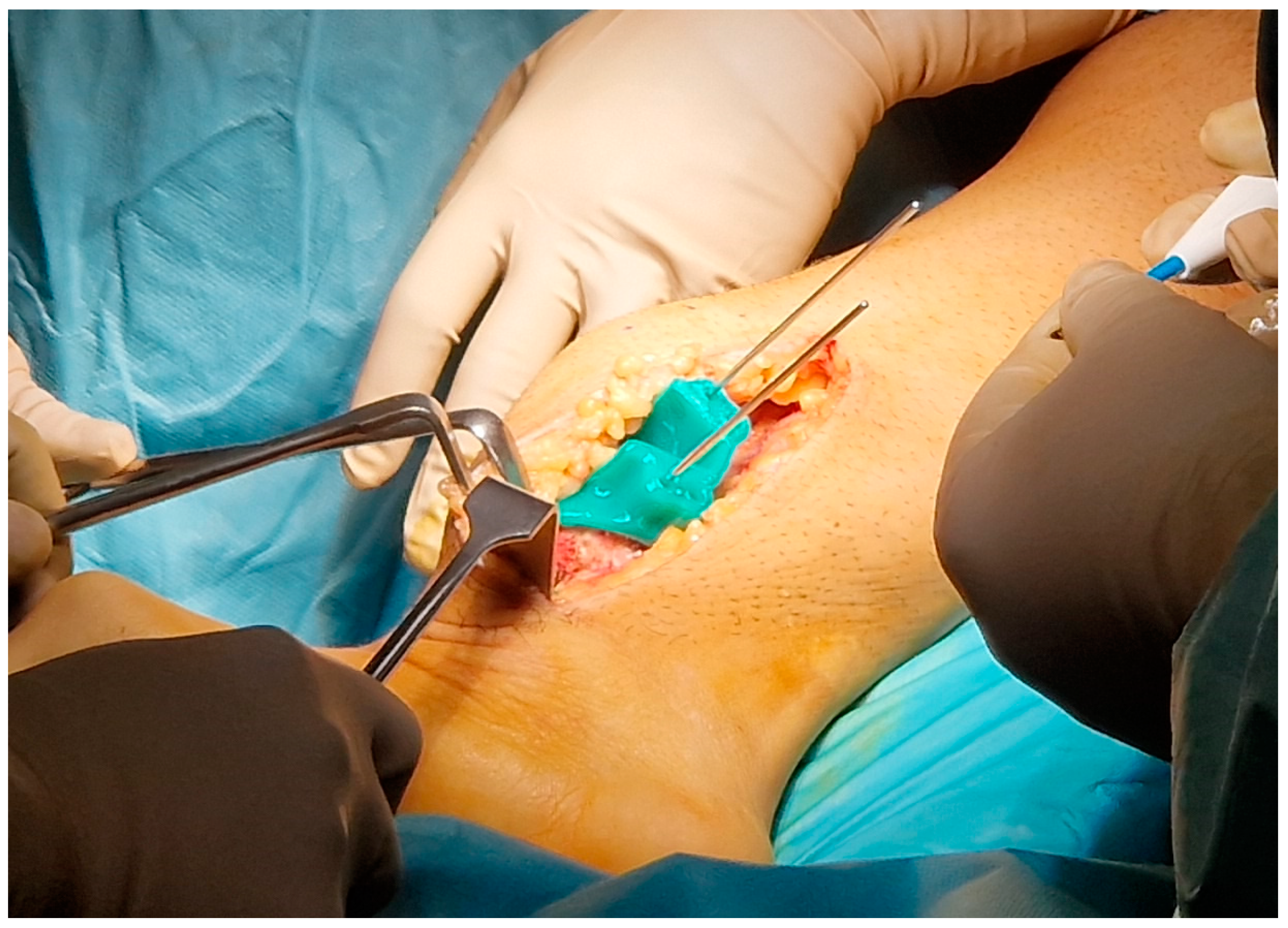 Polymers 16 01216 g002