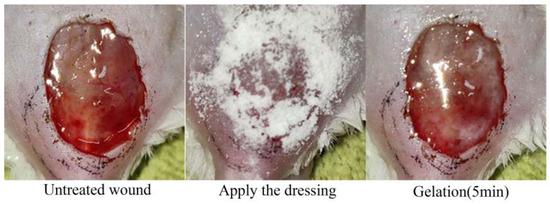 Development and Evaluation of a Novel Antibacterial Wound Dressing: A  Powder Preparation Based on Cross-Linked Pullulan with Polyhexamethylene  Biguanide for Hydrogel-Transition in Advanced Wound Management and  Infection Control