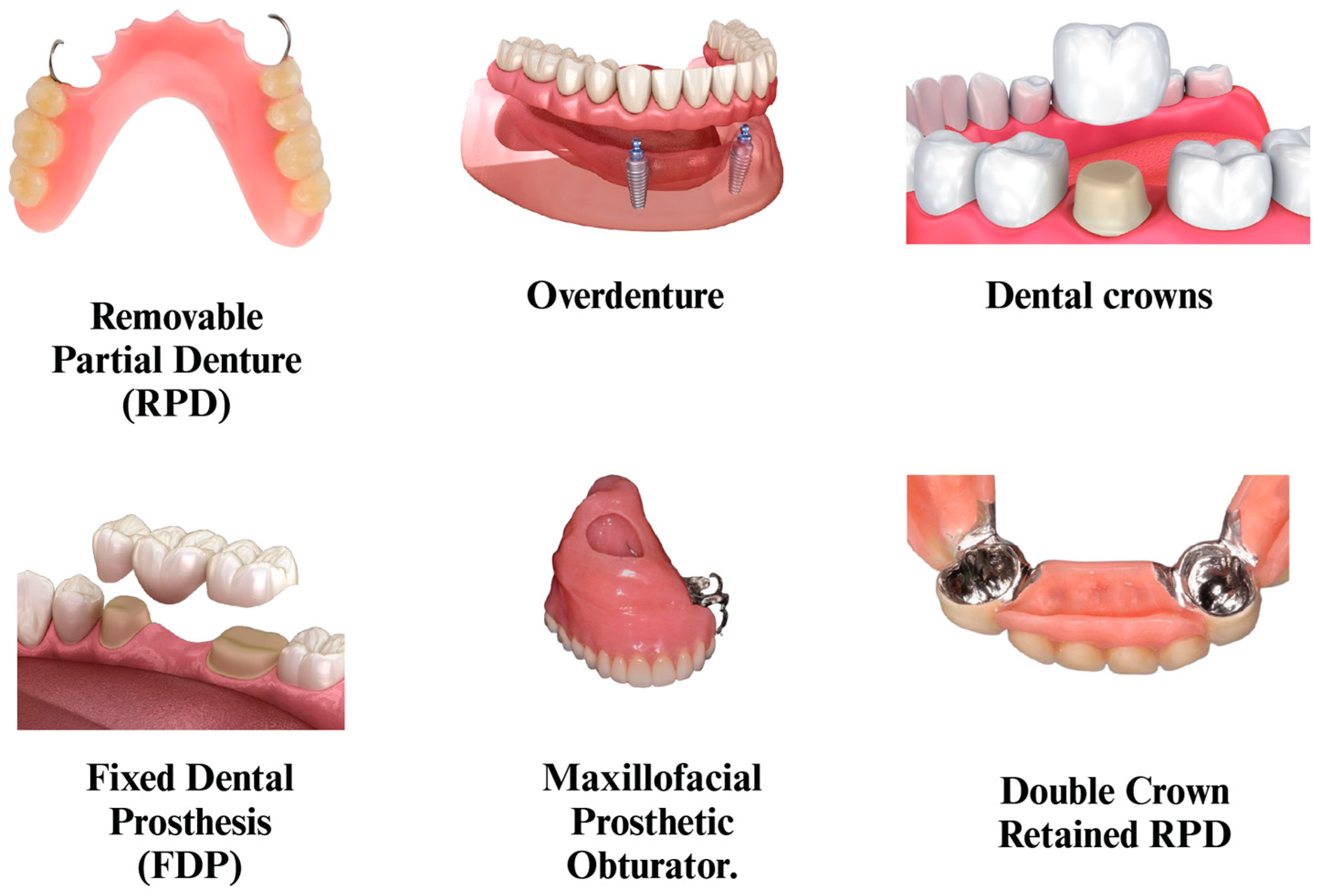 Polymers 17 00080 g007