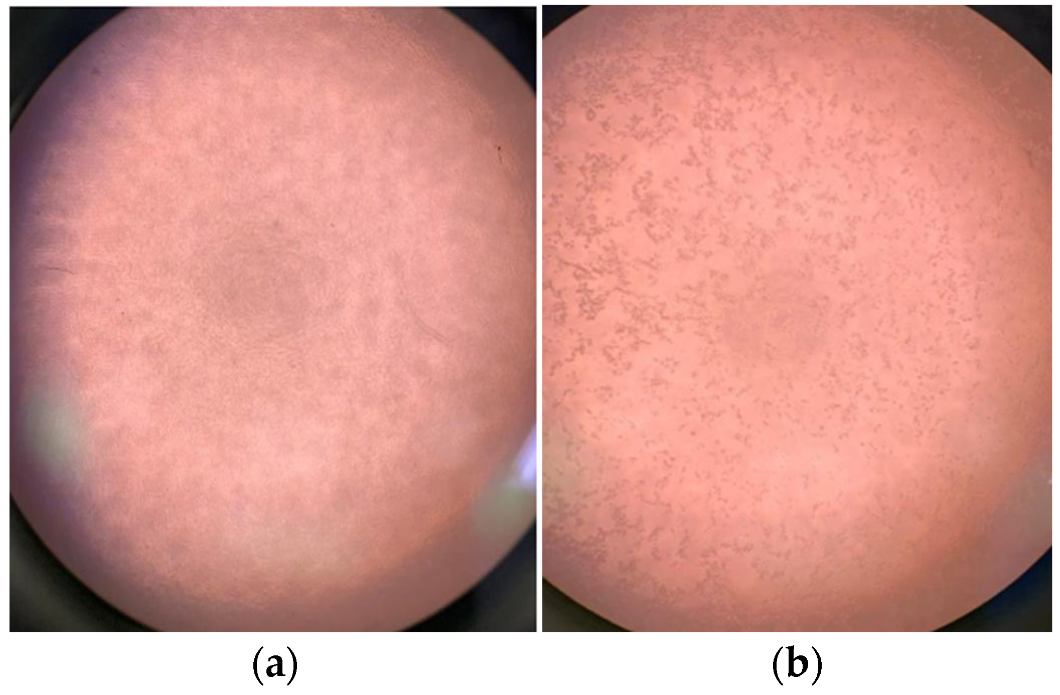 Polymers 17 00283 g011