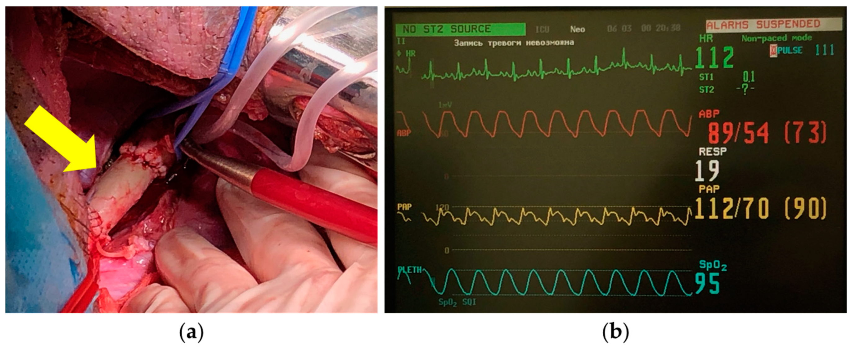 Polymers 17 00305 g010
