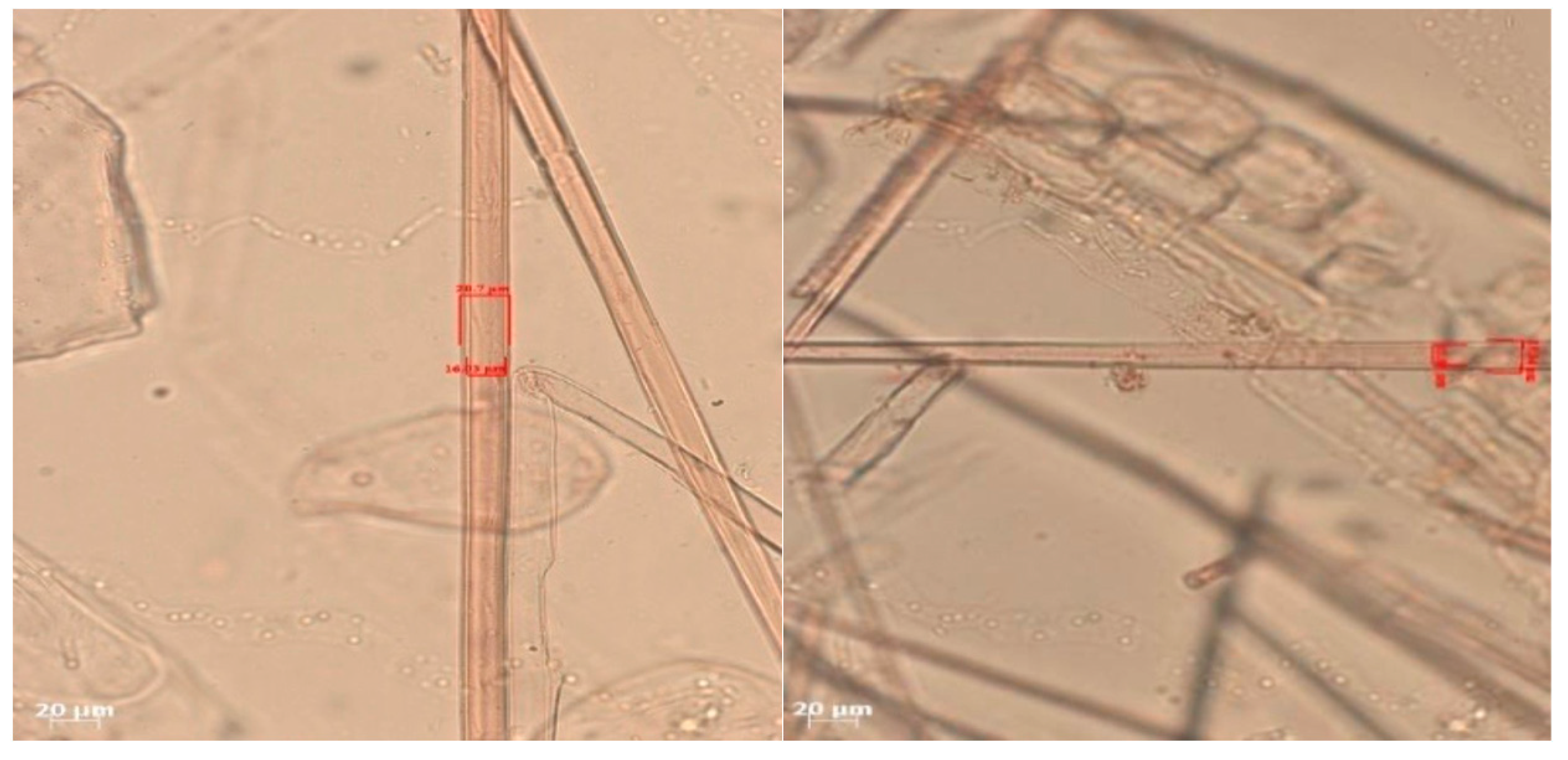 Polymers 17 00512 g012