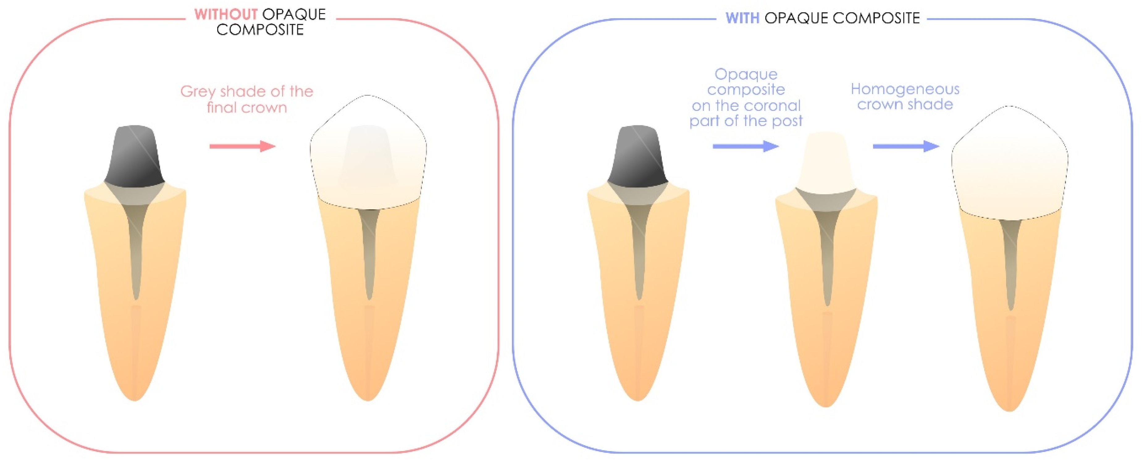 Polymers 17 00564 g008