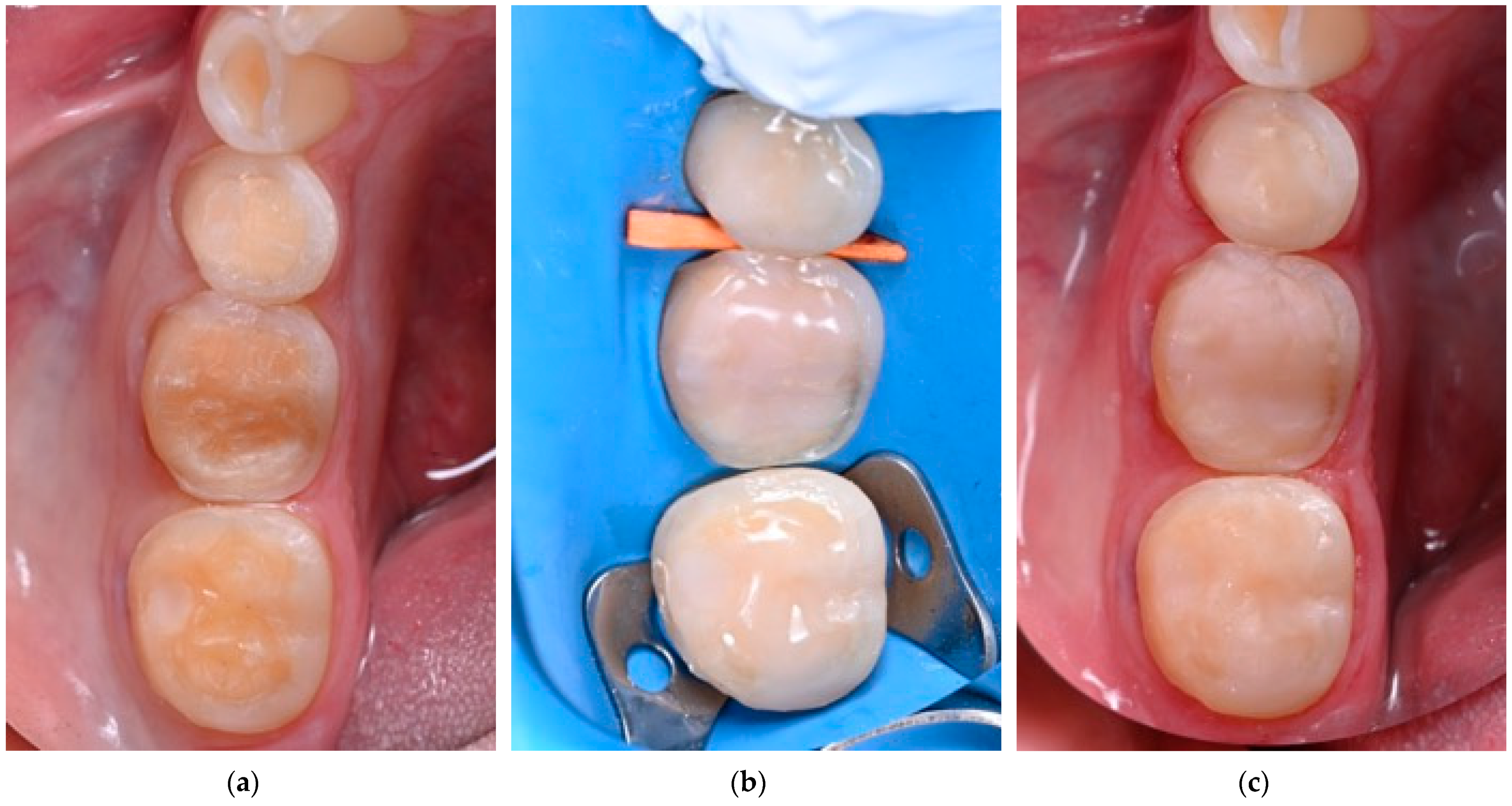 Polymers 17 00566 g005 Polymers 17 00566 g005
