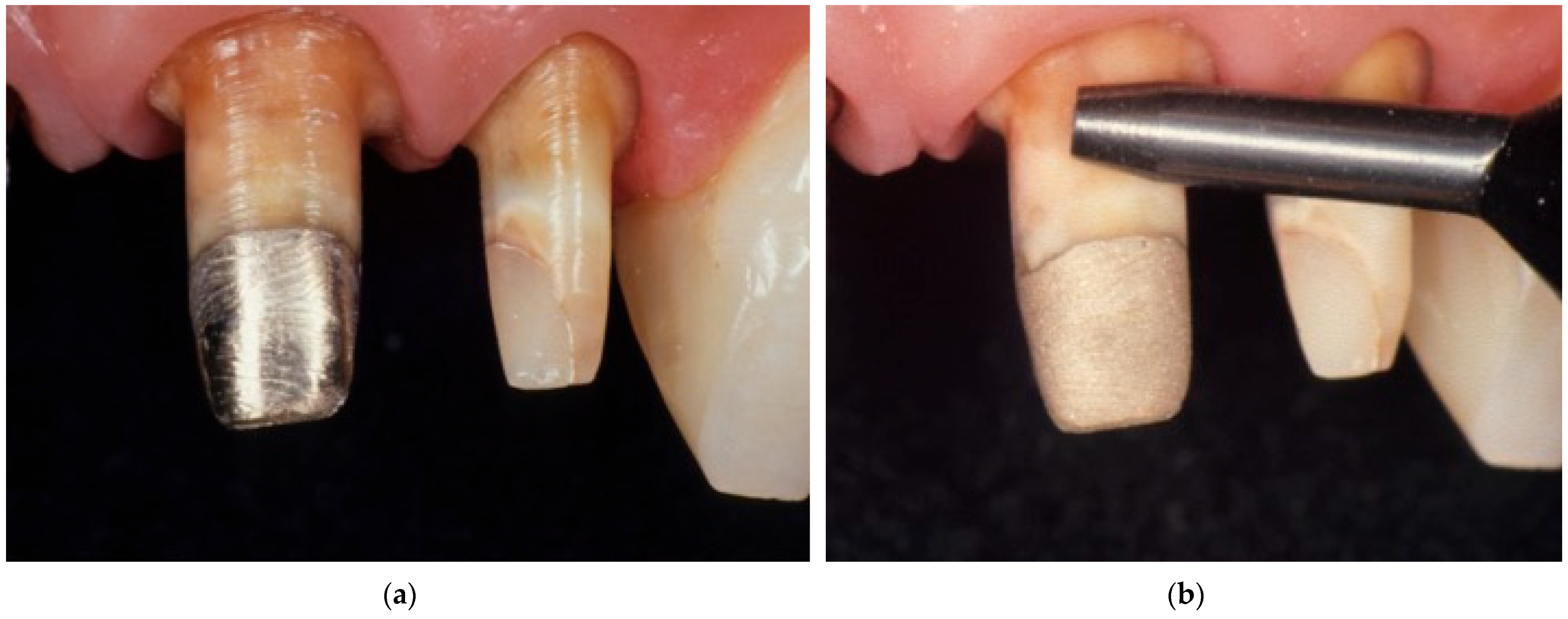 Polymers 17 00566 g006 Polymers 17 00566 g006
