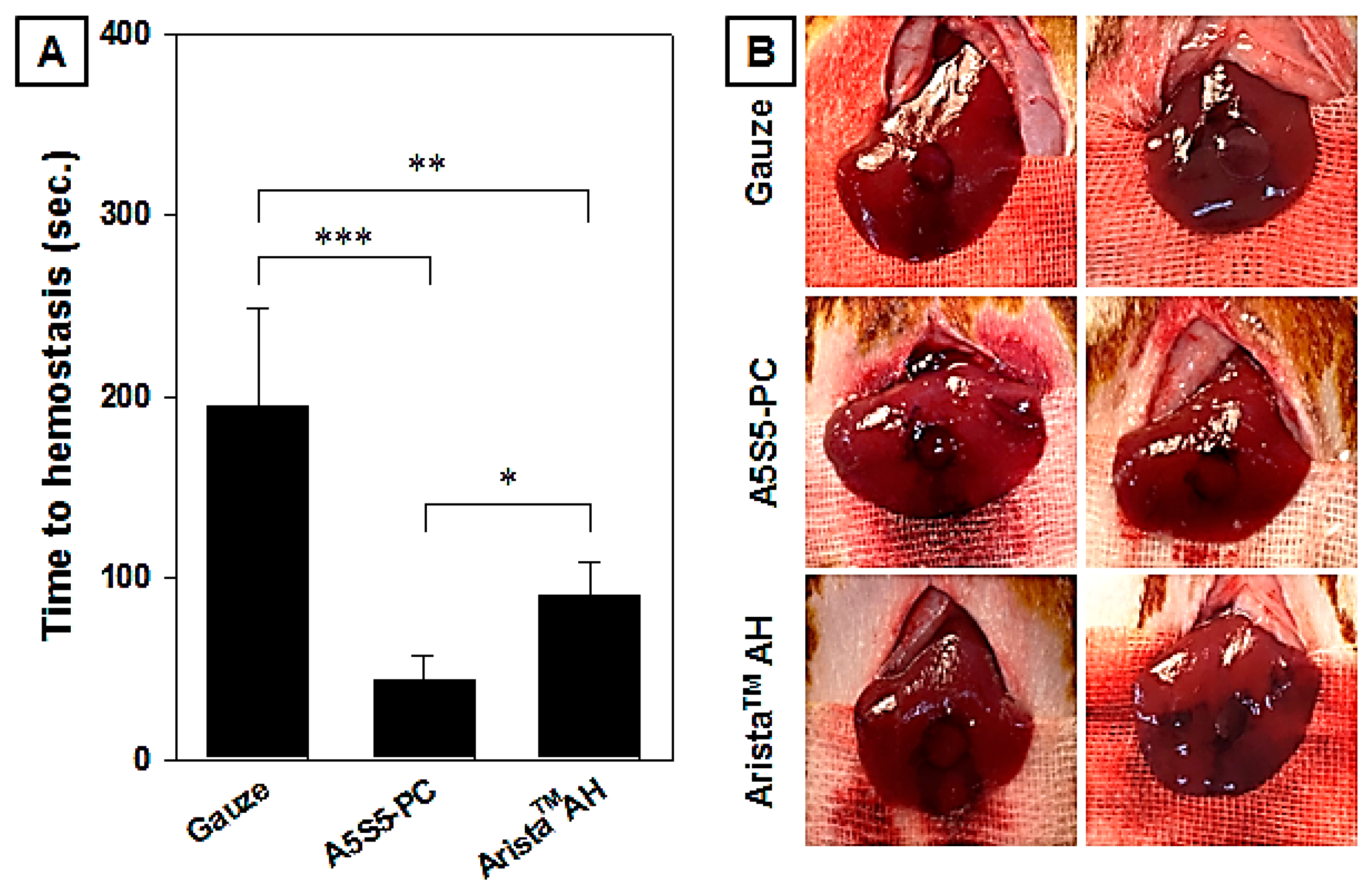 Polymers 17 00568 g011