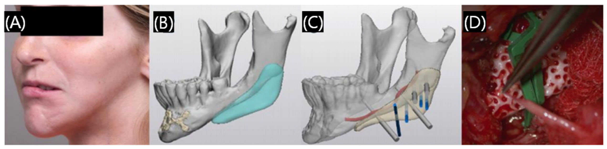 Polymers 17 00886 g012