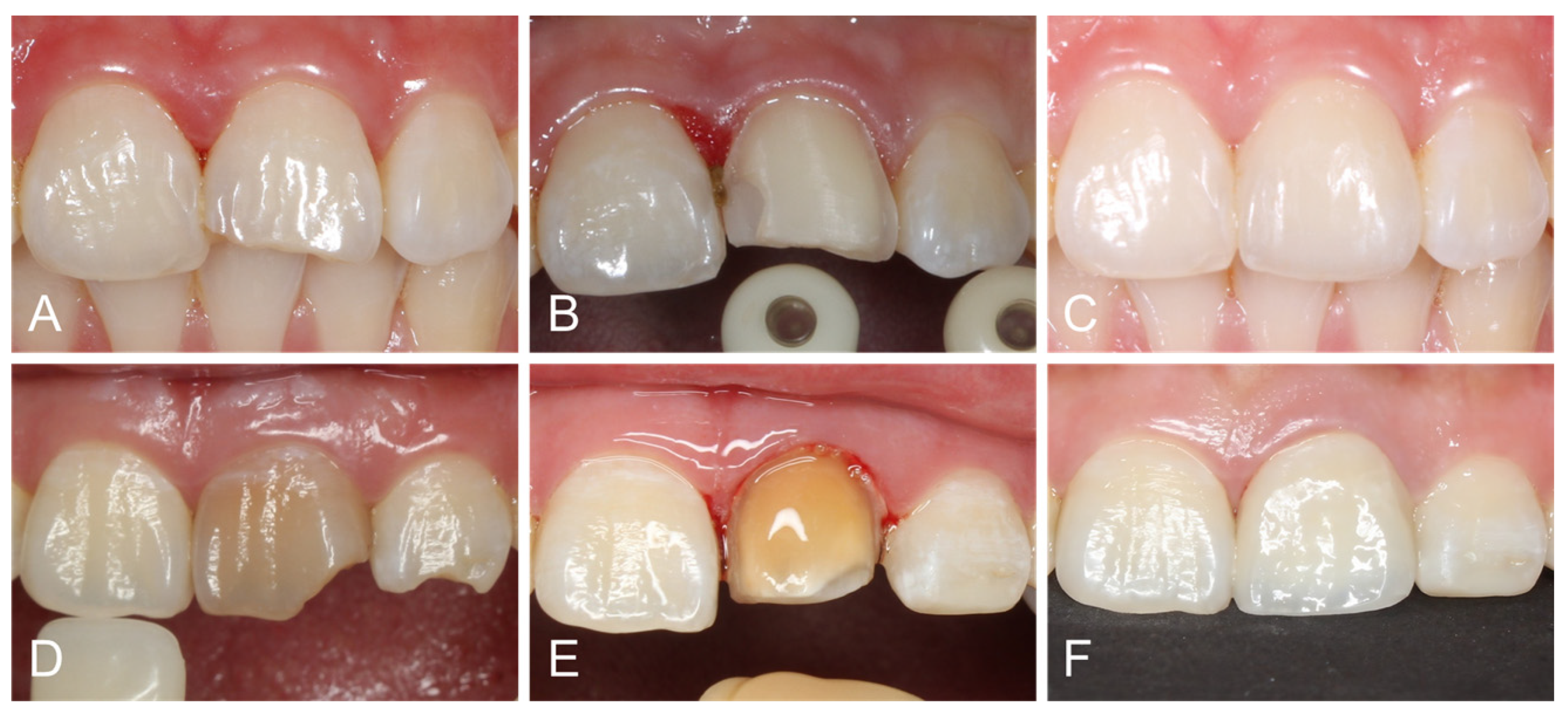 Polymers 17 01213 g002