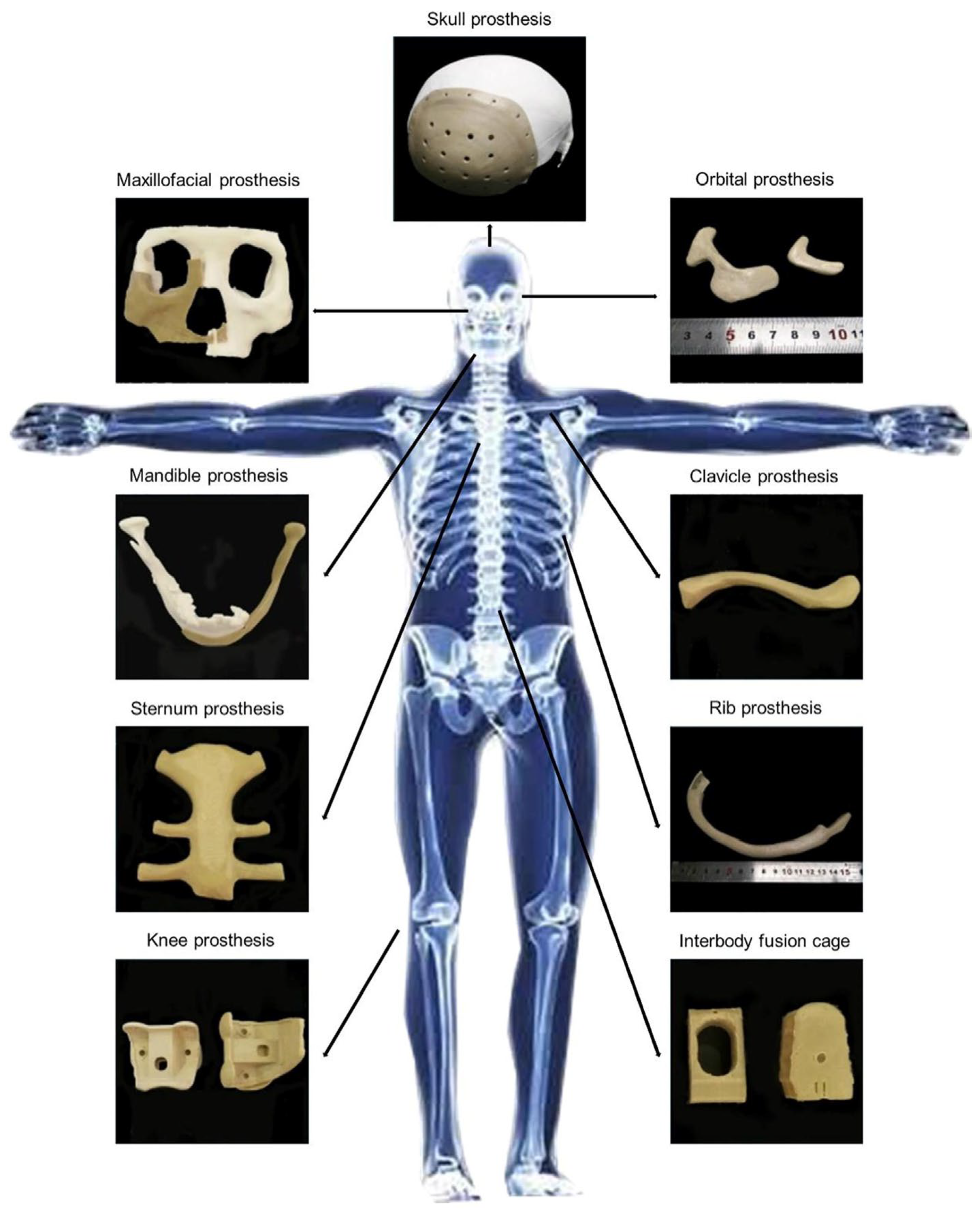 Recent Advances in PEEK for Biomedical Applications: A