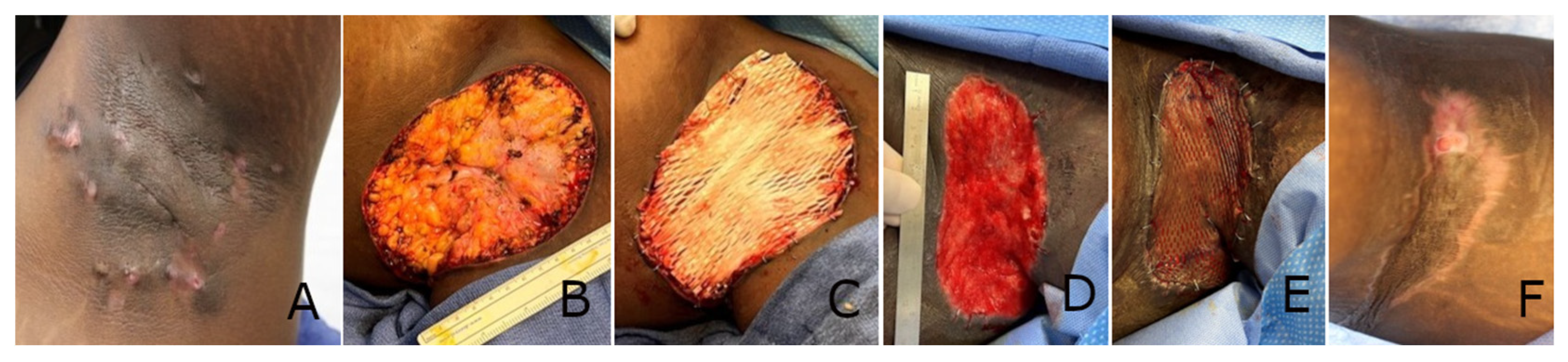 Polymers 17 02563 g001 Polymers 17 02563 g001