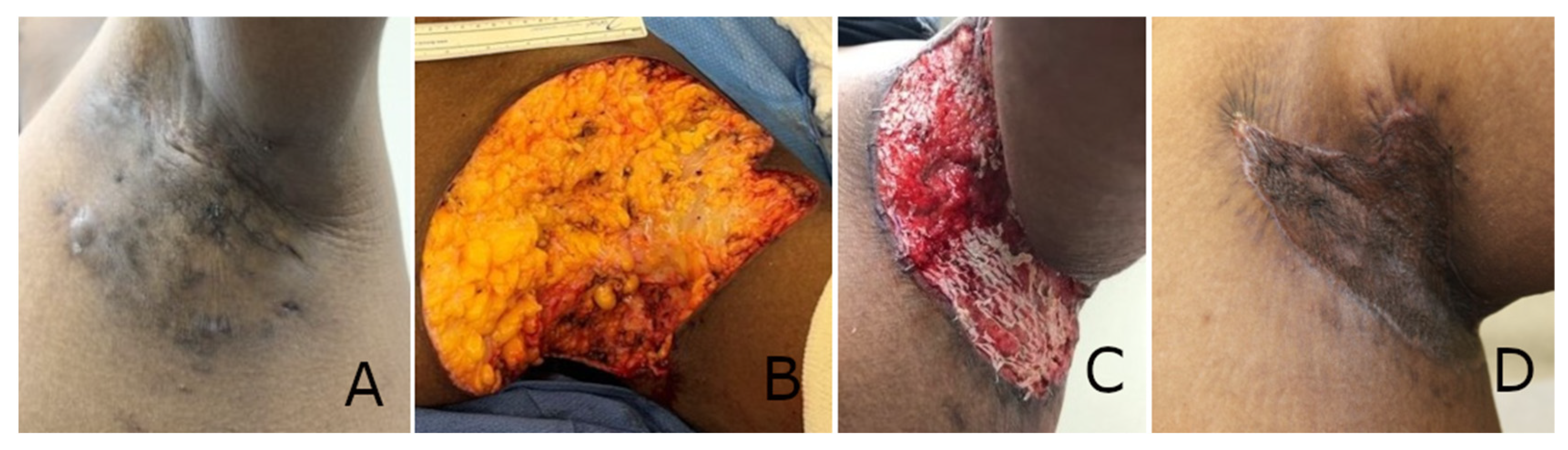 Polymers 17 02563 g002 Polymers 17 02563 g002