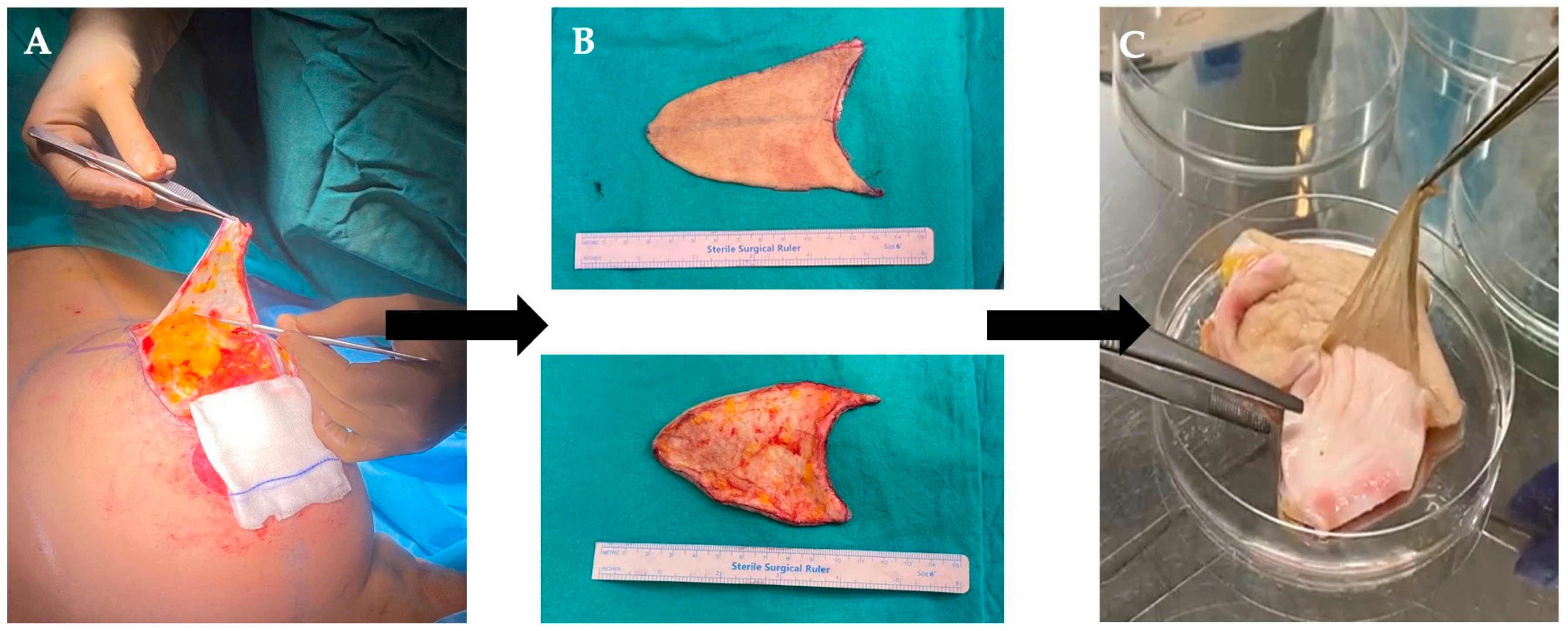 Polymers 17 02647 g001 Polymers 17 02647 g001