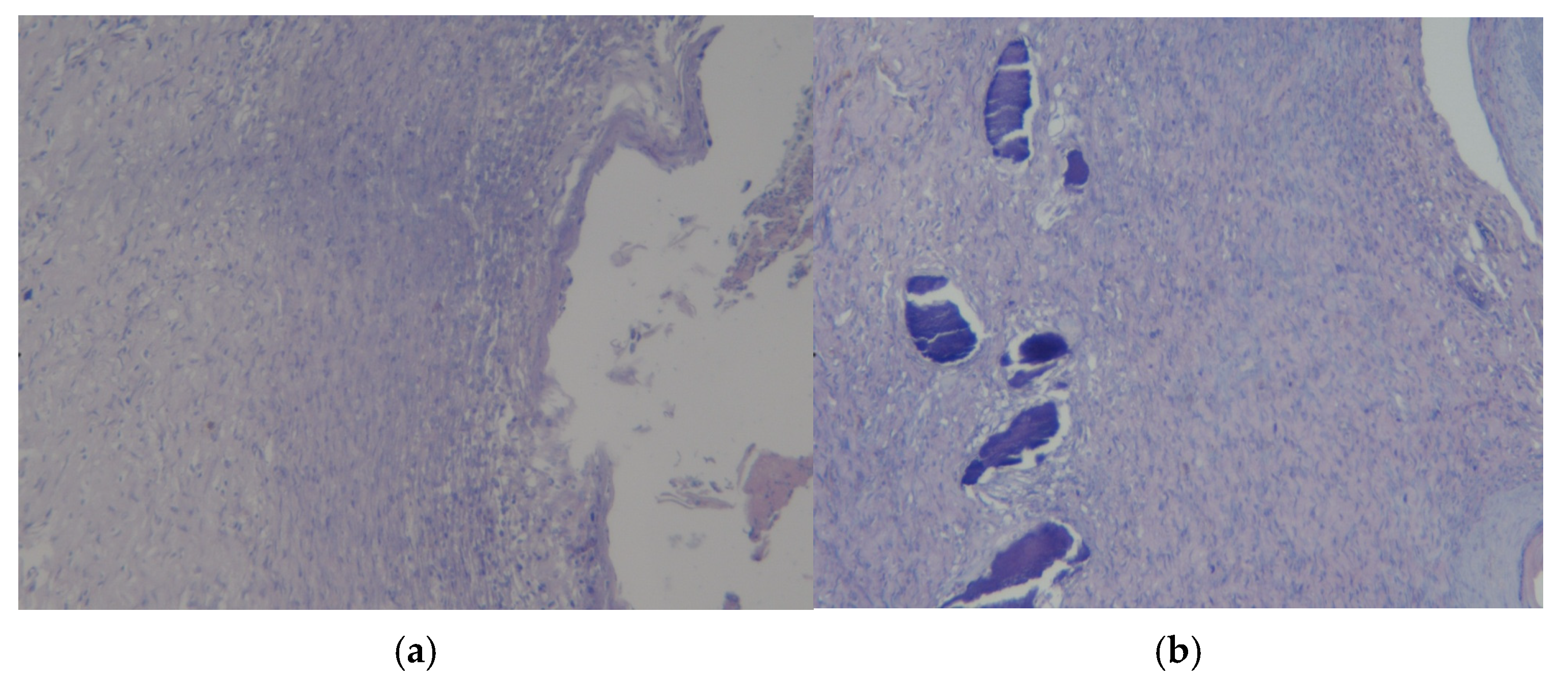 Polymers 17 03215 g011 Polymers 17 03215 g011