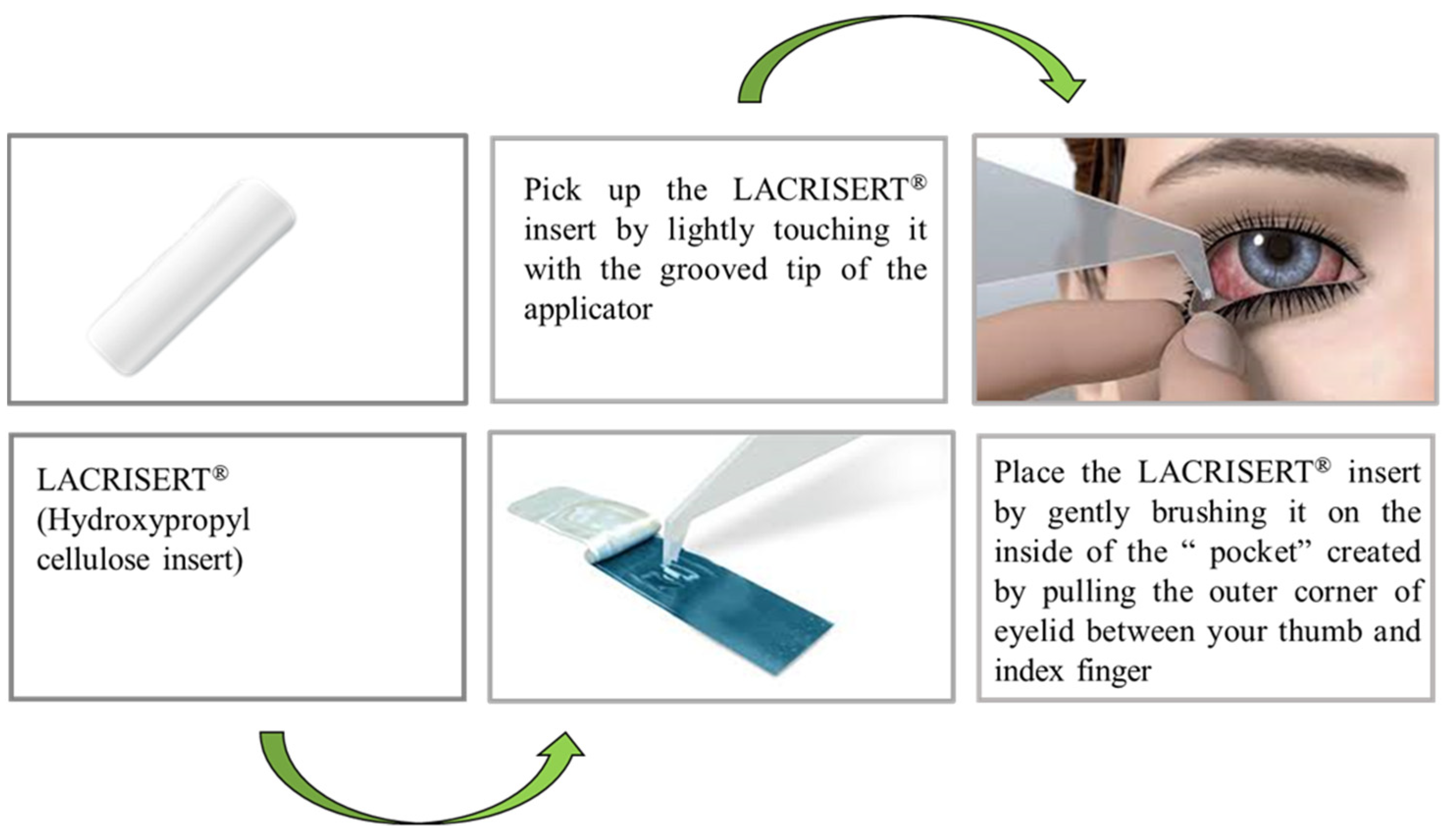 Polysaccharides Free FullText Polysaccharide Based Implantable