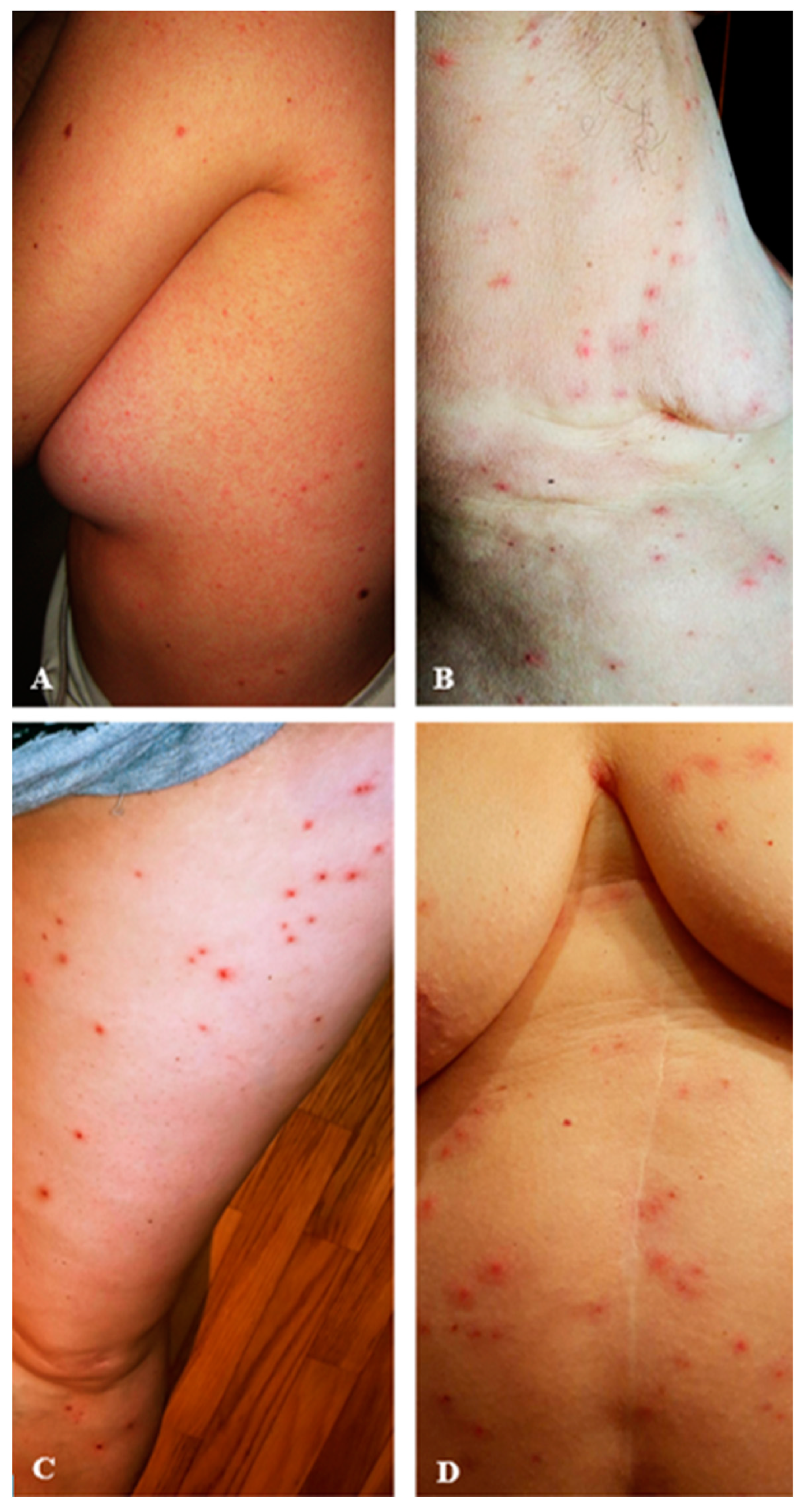 Poultry 04 00021 g004 Poultry 04 00021 g004