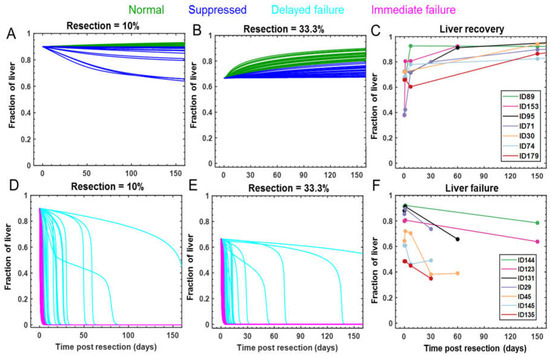 Processes Free Full Text Modeling The Dynamics Of Human Liver Failure Post Liver Resection Html