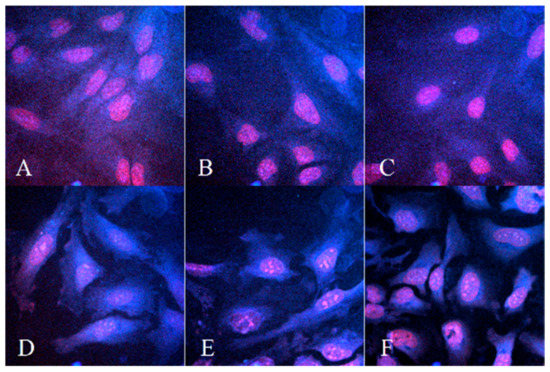 Size-Selected Graphene Oxide Loaded with Photosensitizer (TMPyP) for ...