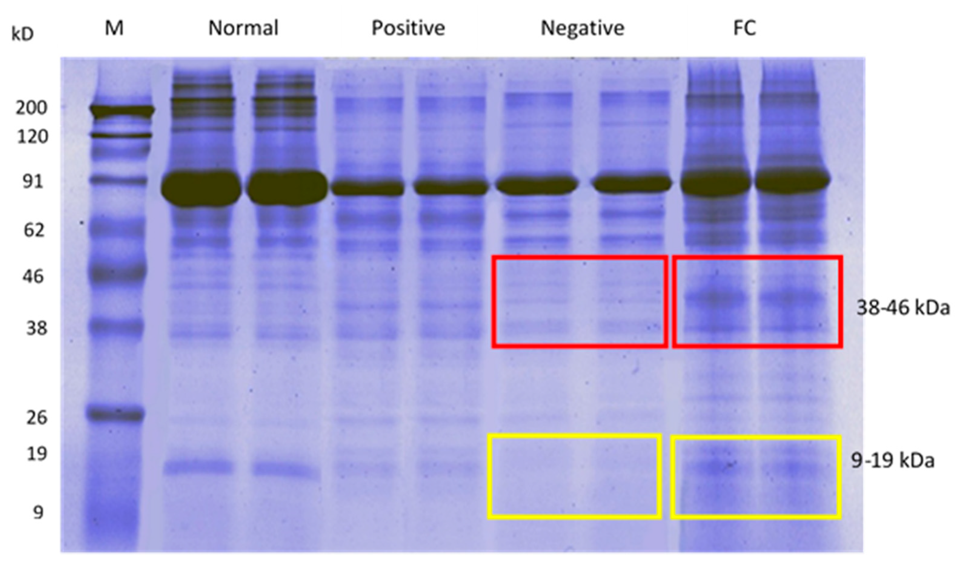 Processes 08 00395 g006