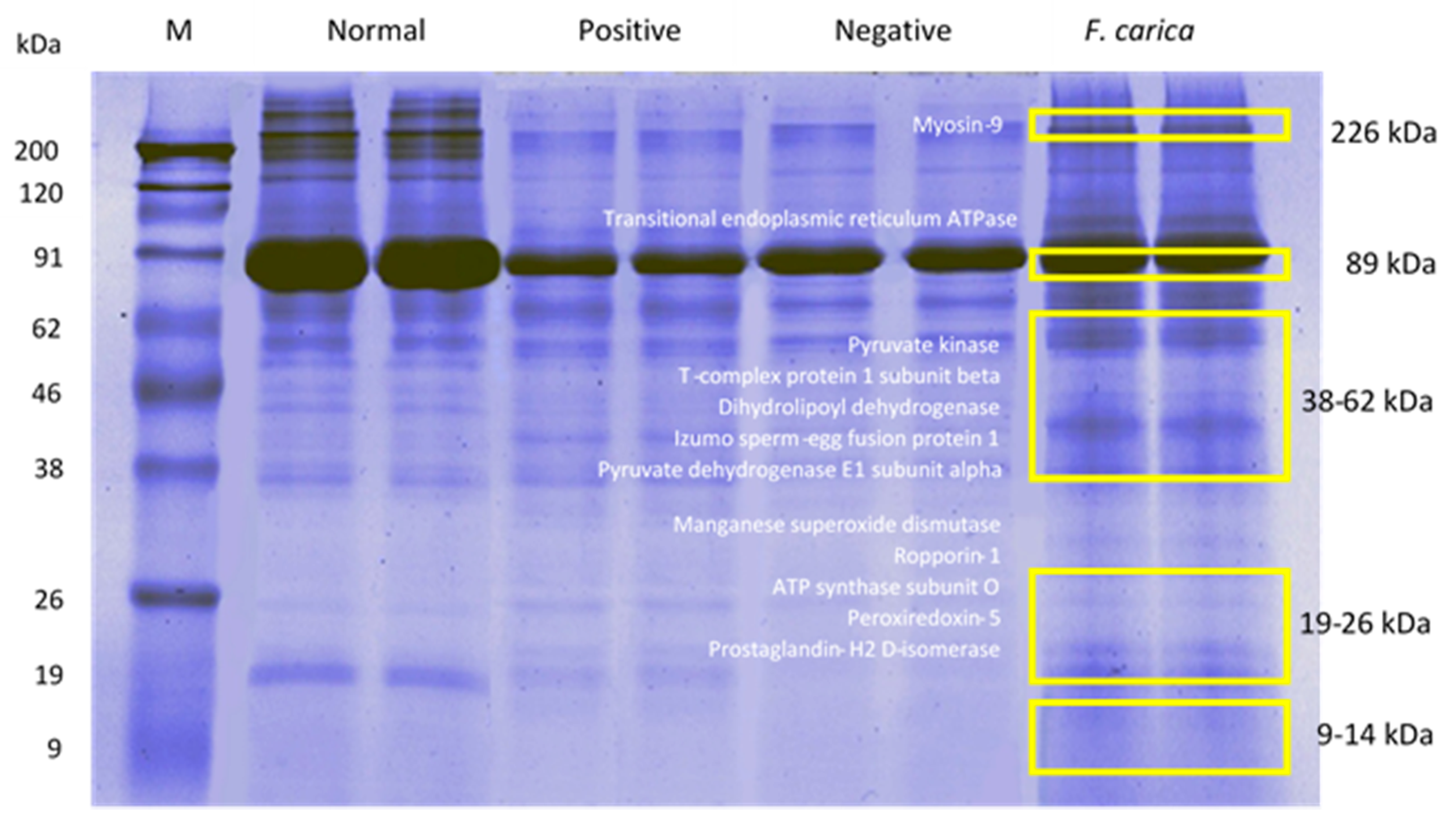Processes 08 00395 g008