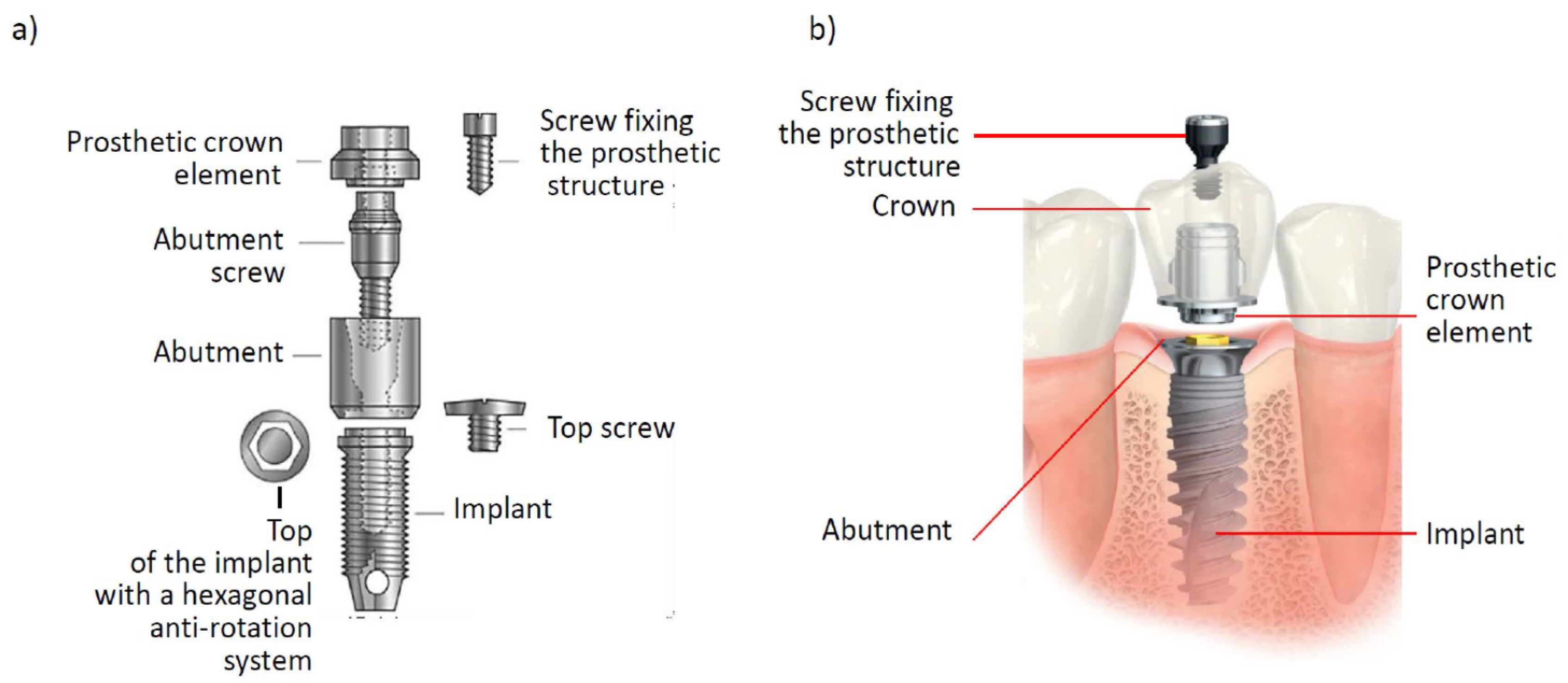 Processes Free FullText Dentistry 4.0 Concept in the Design and