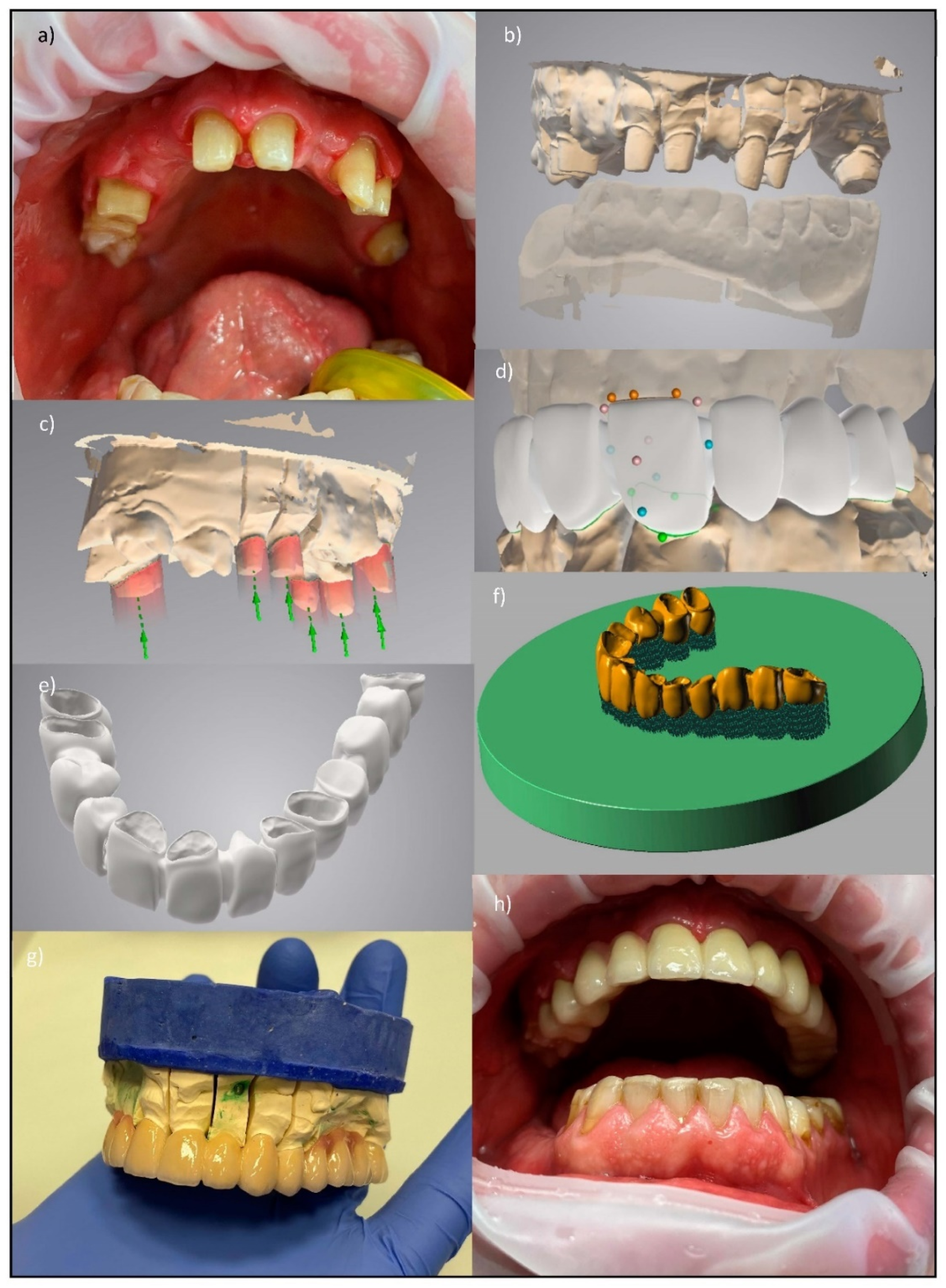 Processes Free Full Text Dentistry 4 0 Concept In The Design And Manufacturing Of Prosthetic Dental Restorations Html Processes Free Full Text Dentistry 4 0 Concept In The Design And Manufacturing Of Prosthetic Dental Restorations Html