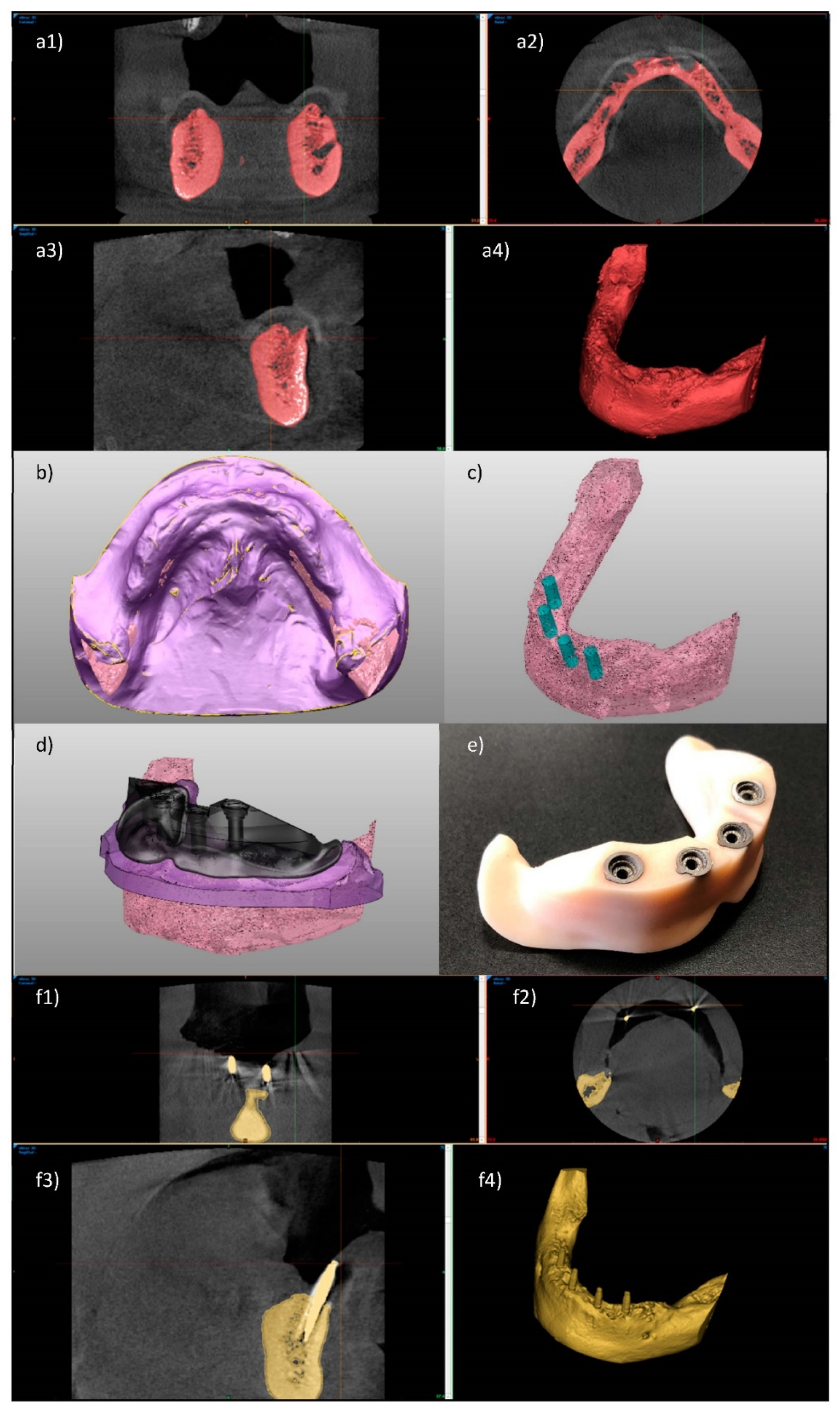 Processes 08 00525 g017