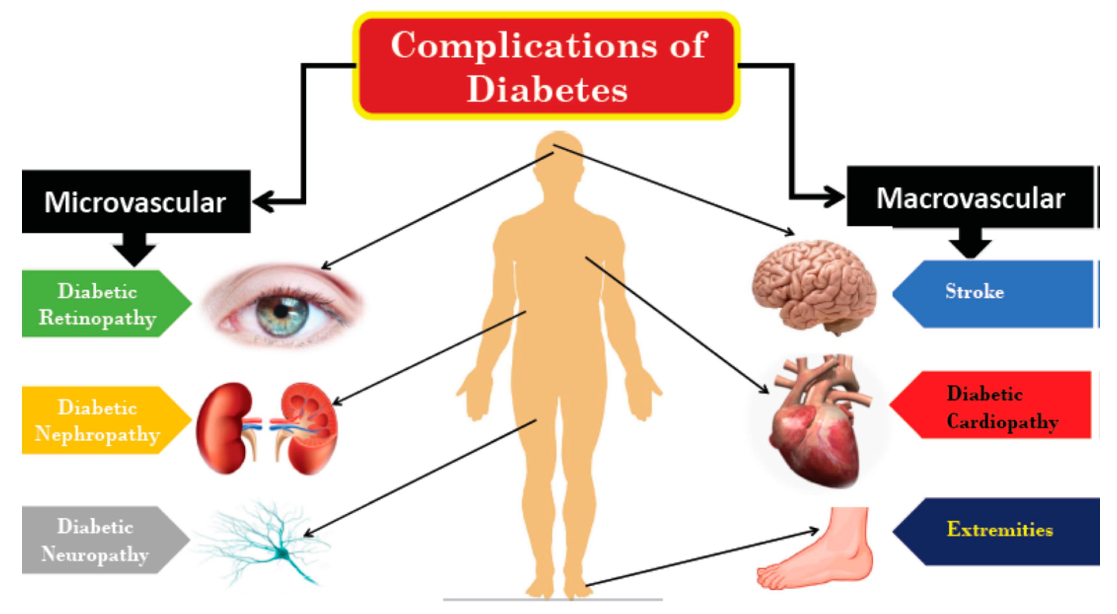 Modeling long-term diabetes and related complications in rats