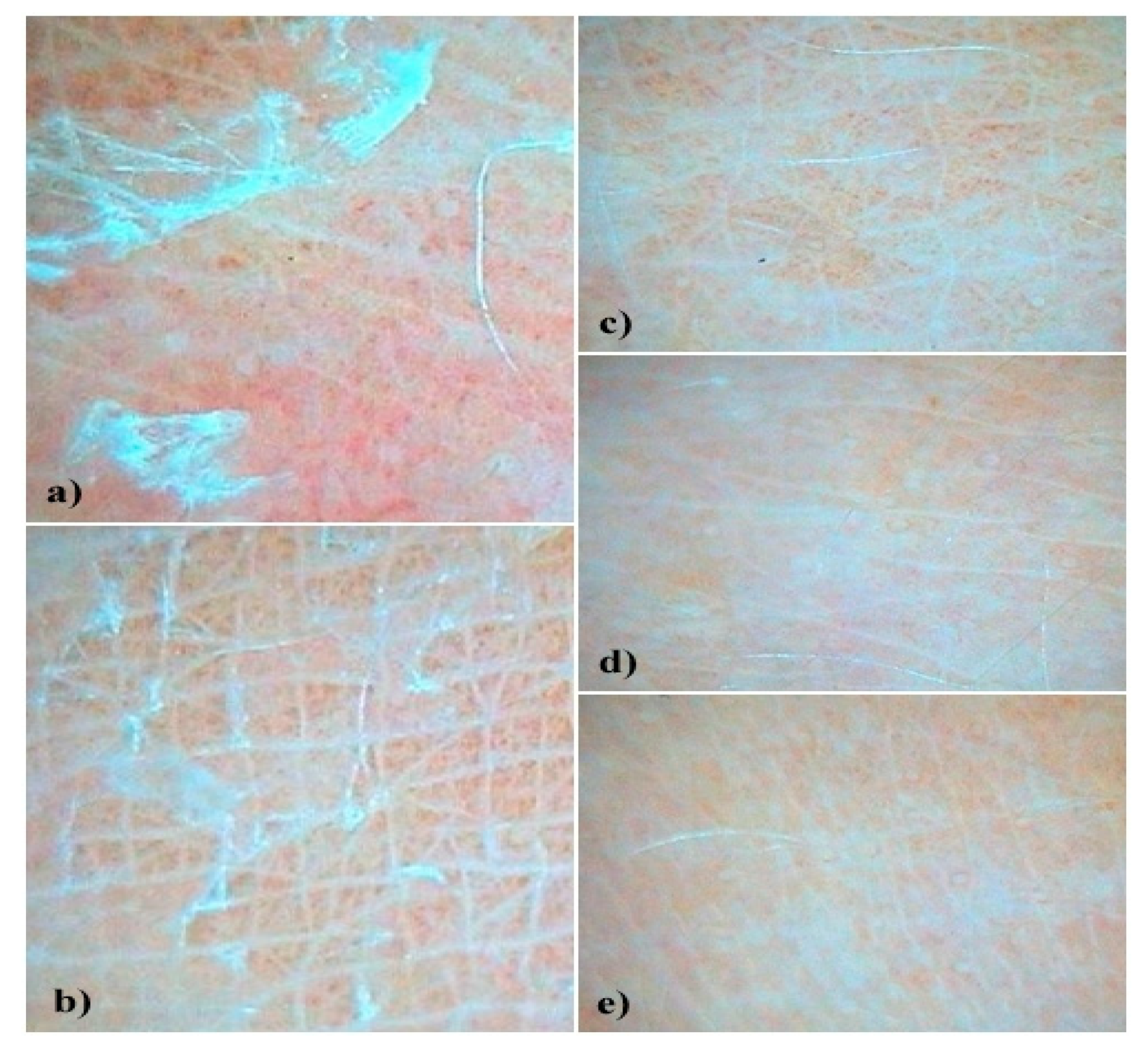 Nanoemulsion Gel Formulation Optimization for Burn Wounds