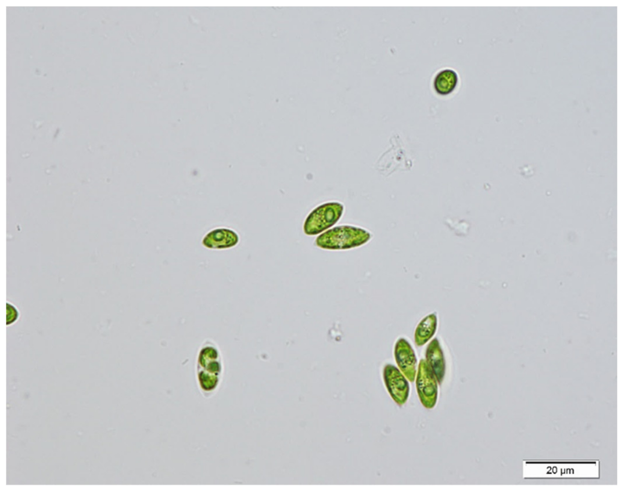 Processes | Free Full-Text | Enhancement of Biomass and Lipid  Productivities of Scenedesmus sp. Cultivated in the Wastewater of the Dairy  Industry