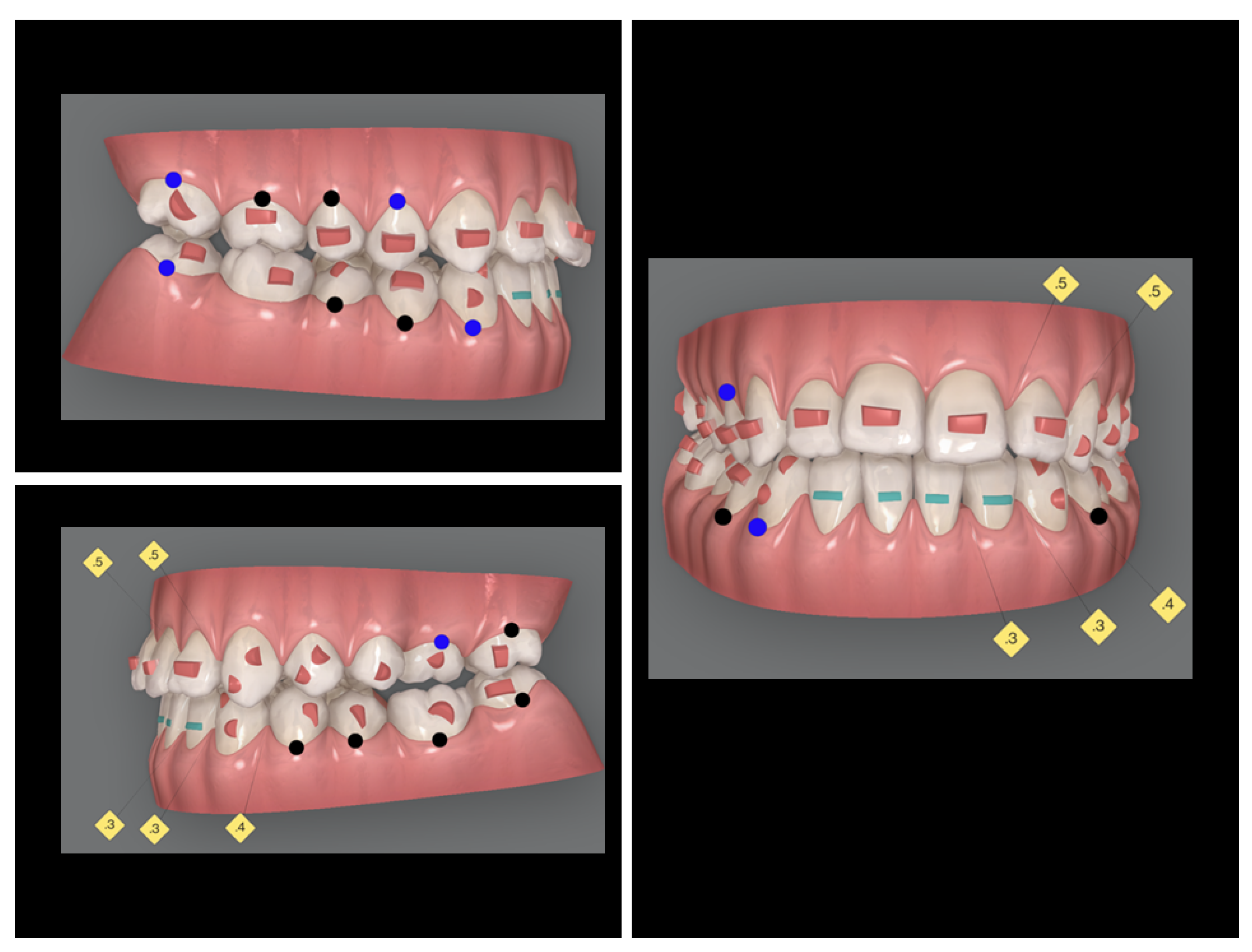 Advanced Digital 3D Technology in the Combined Surgery-First ...