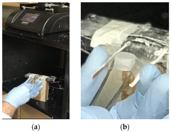 glutathione-immobilized microbeads Glutathione Immobilized Polycaprolactone Nanofiber Mesh as a Dermal Drug  Delivery Mechanism for Wound Healing in a Diabetic Patient
