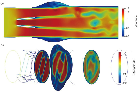 The Numerical Analysis of Non-Newtonian Blood Flow in a Mechanical ...