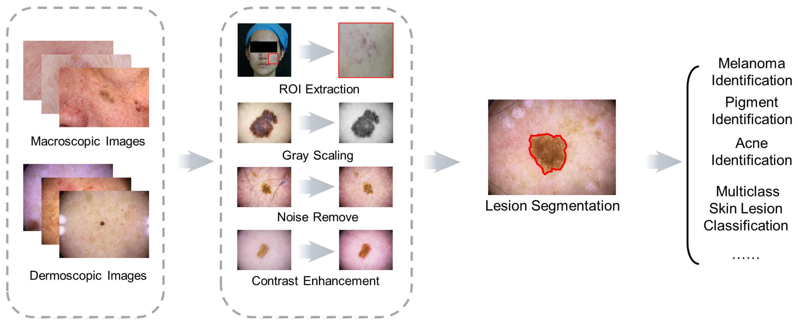 Processes | Free Full-Text | Machine Learning Methods in Skin Disease ...