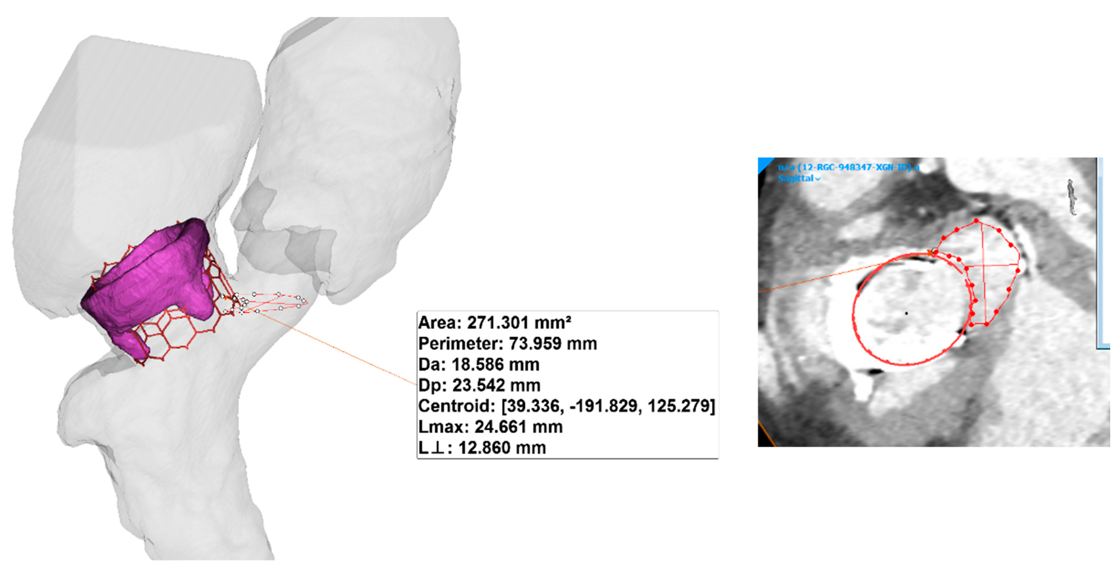 Prosthesis 02 00004 g003