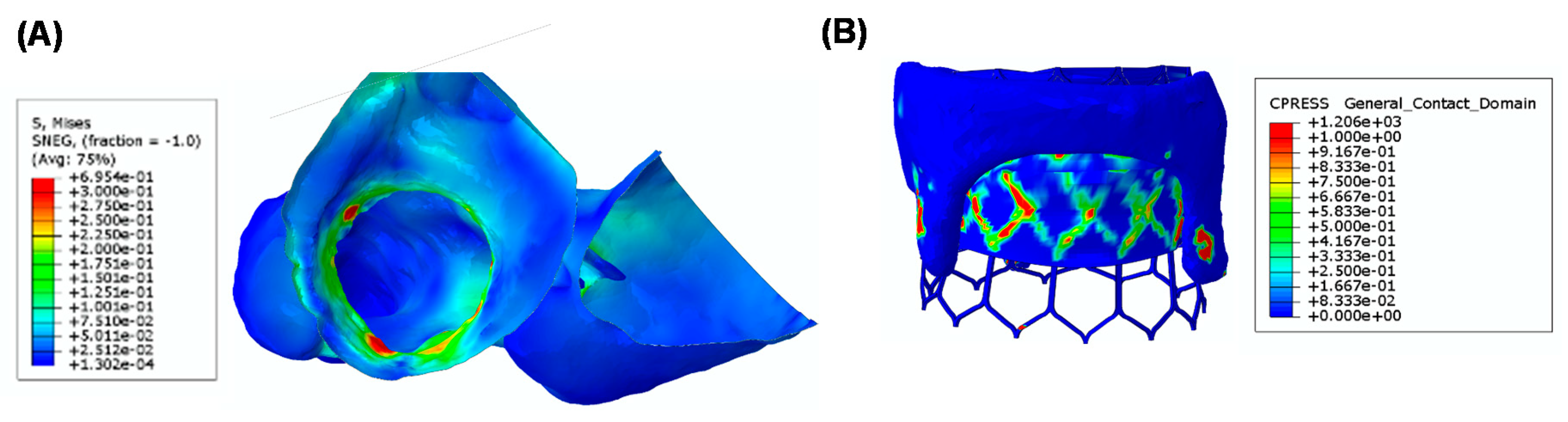 Prosthesis 02 00004 g005