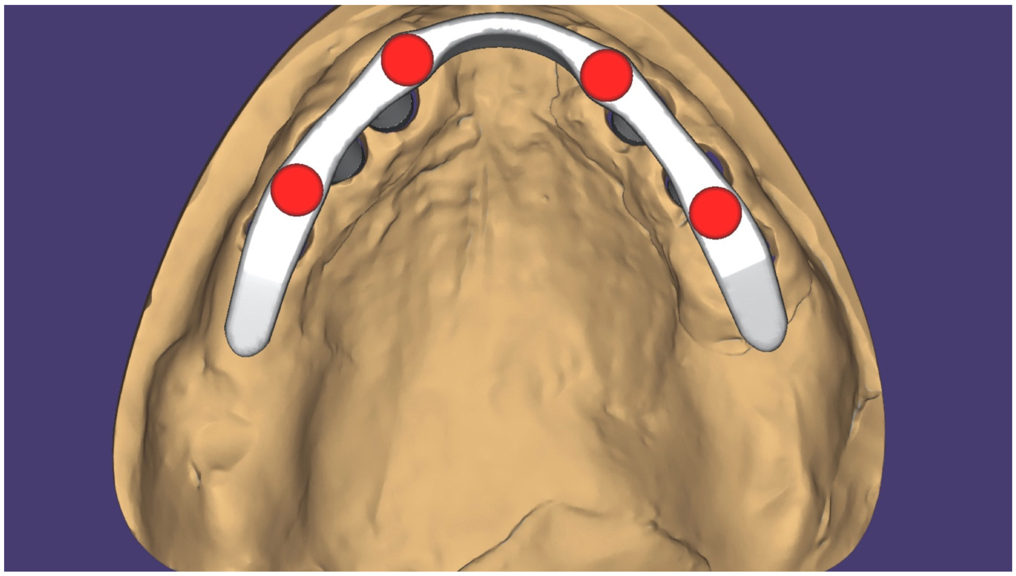 Prosthesis Free FullText Minimally Invasive Treatment of