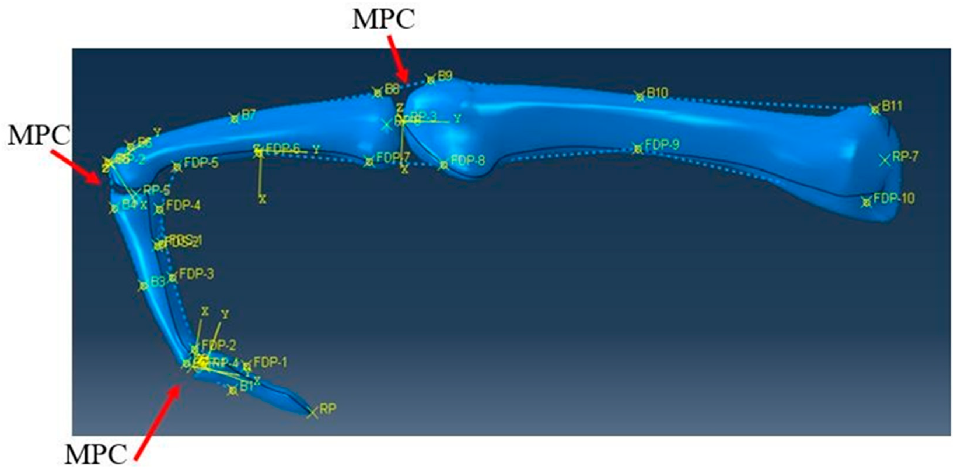 Prosthesis 02 00015 g011 Prosthesis 02 00015 g011