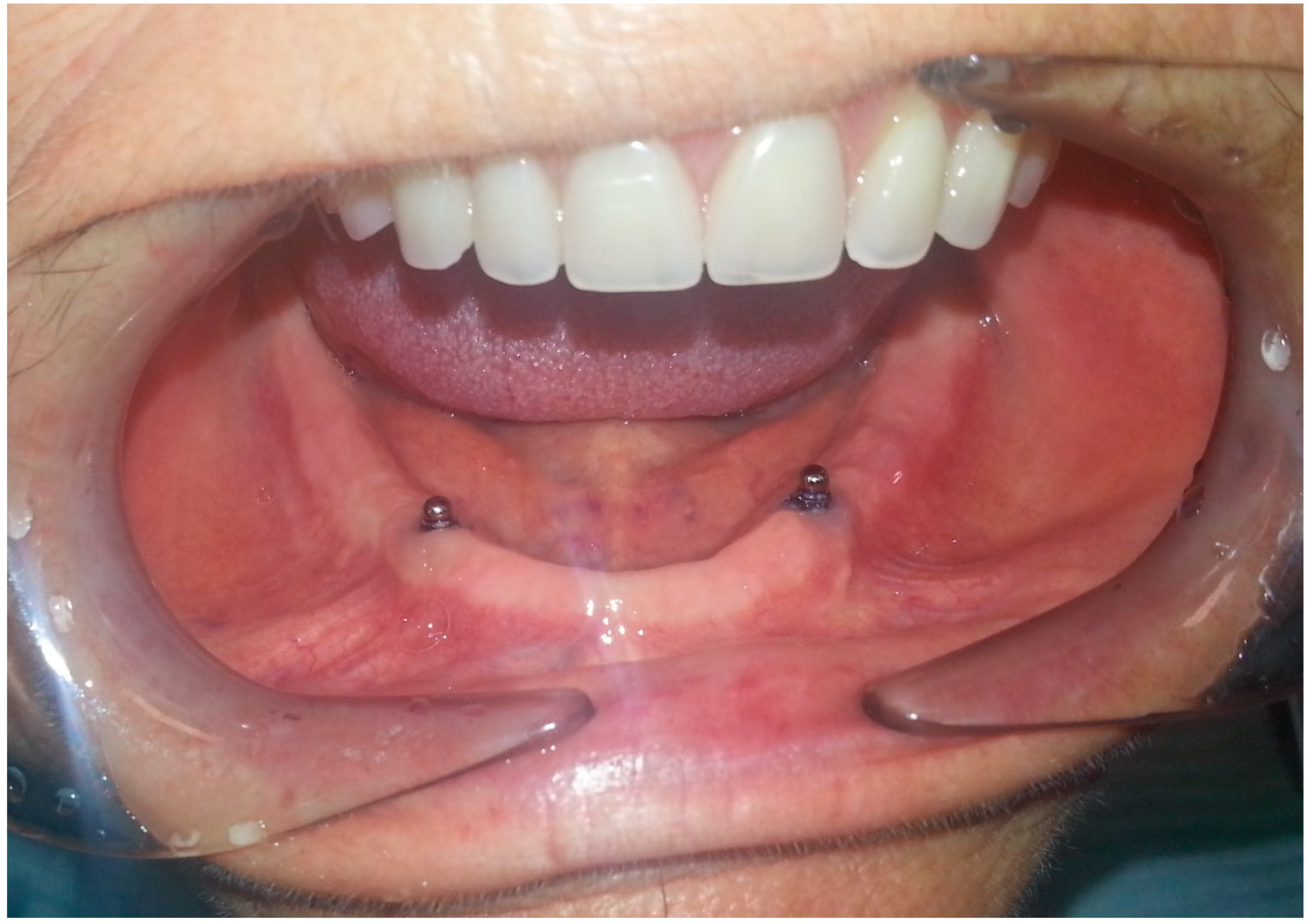 Prosthesis 02 00016 g001 Prosthesis 02 00016 g001