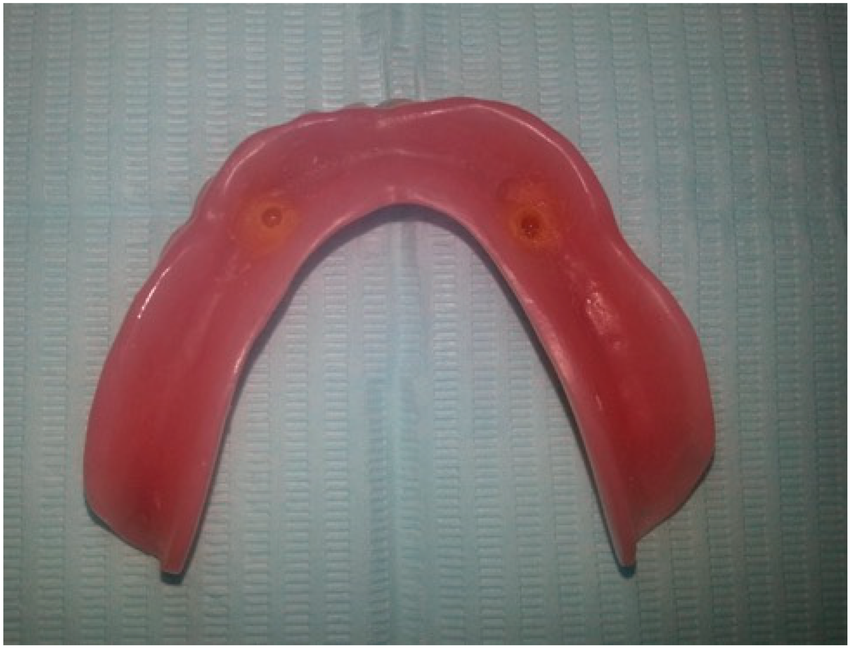 Prosthesis 02 00016 g003 Prosthesis 02 00016 g003