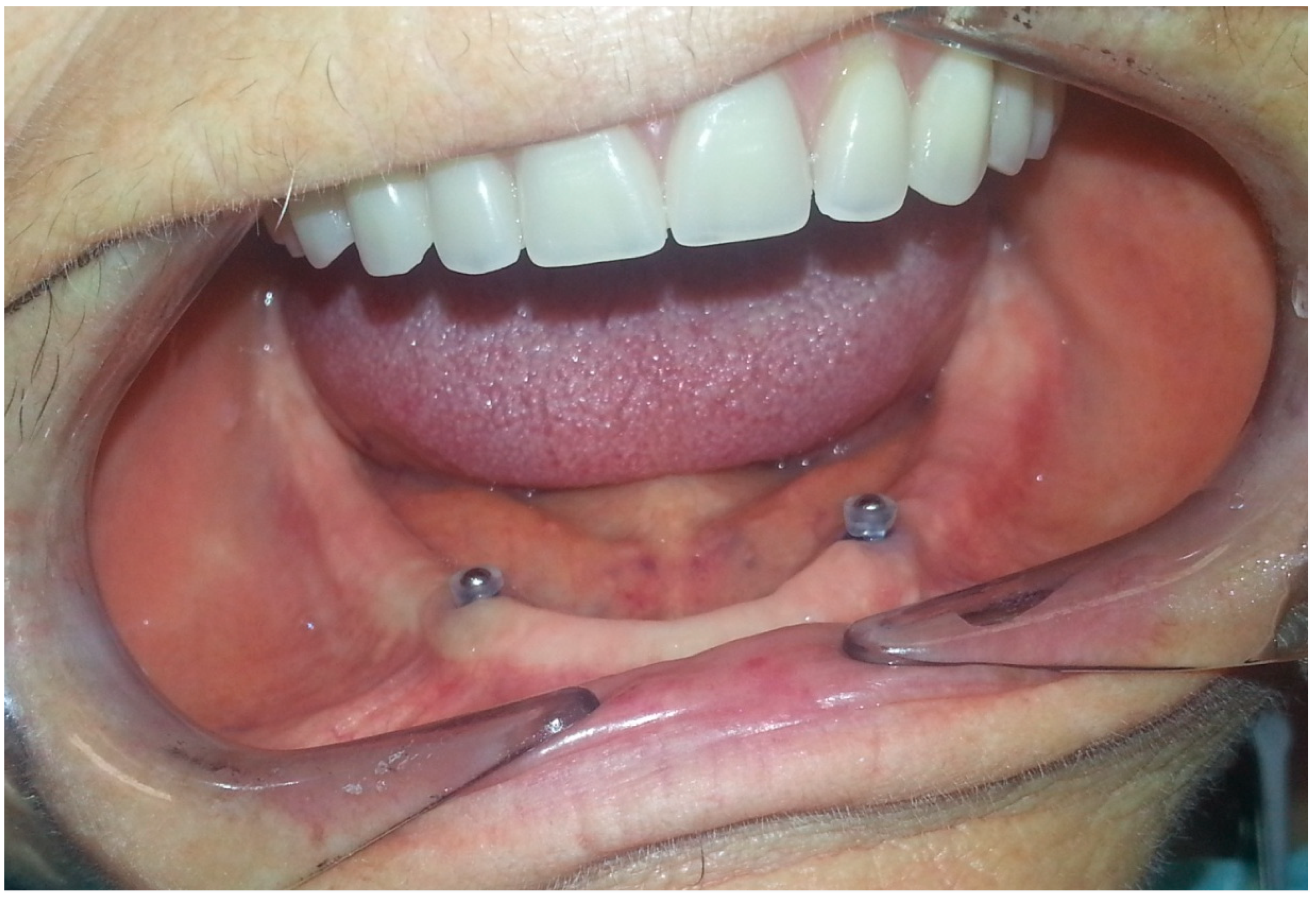 Prosthesis 02 00016 g005 Prosthesis 02 00016 g005