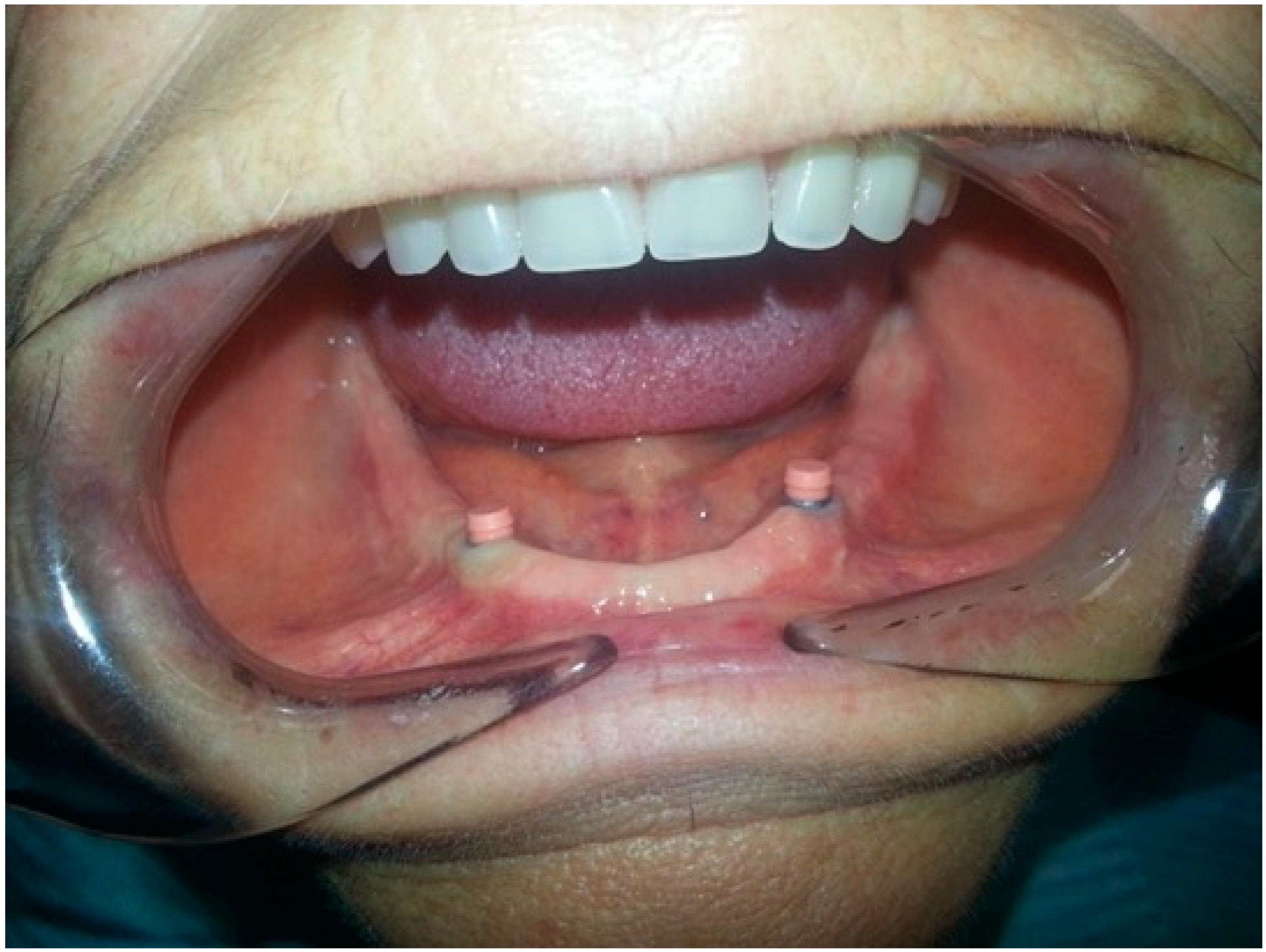 Prosthesis 02 00016 g006 Prosthesis 02 00016 g006