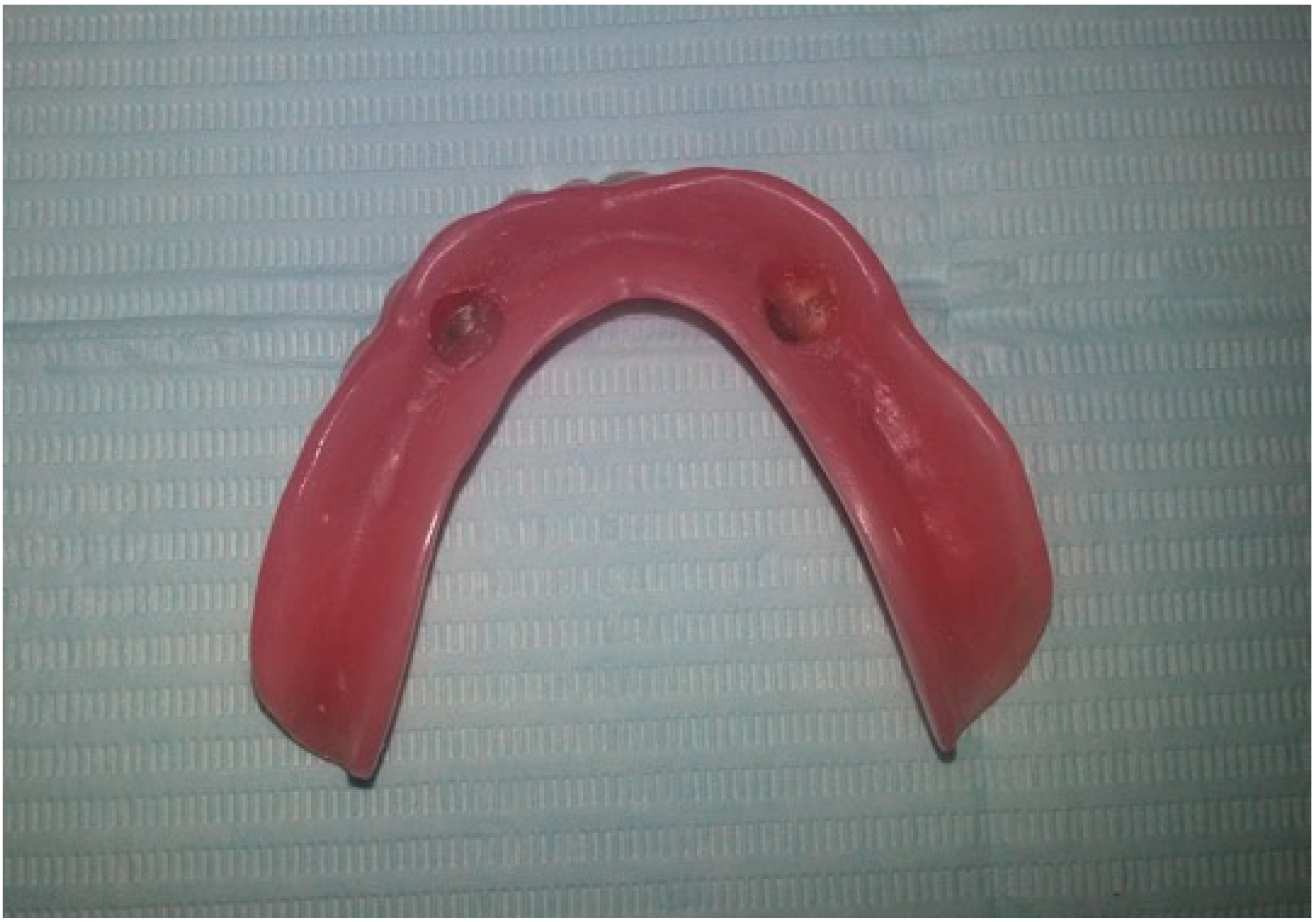 Prosthesis 02 00016 g008 Prosthesis 02 00016 g008