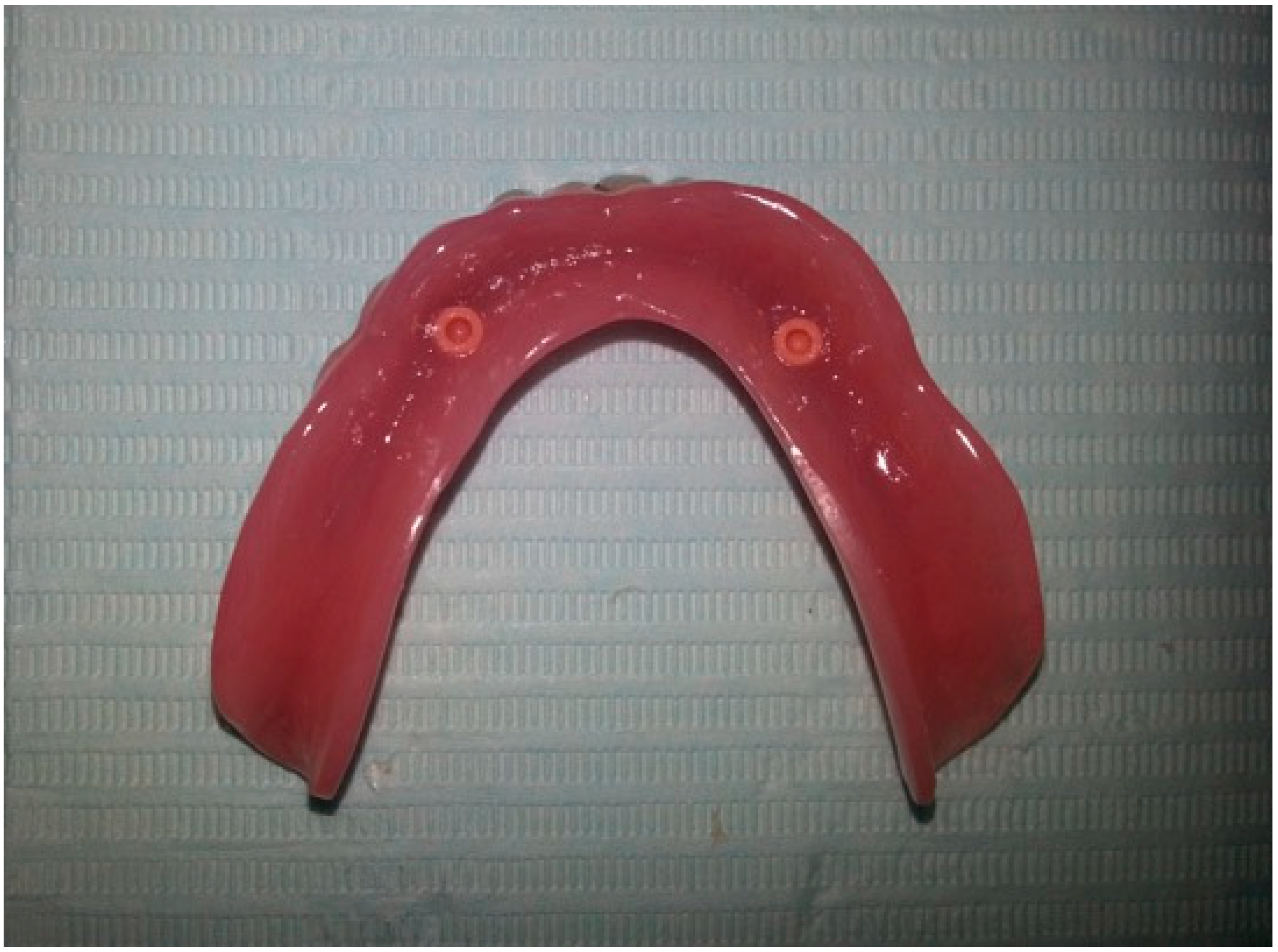 Prosthesis 02 00016 g011 Prosthesis 02 00016 g011